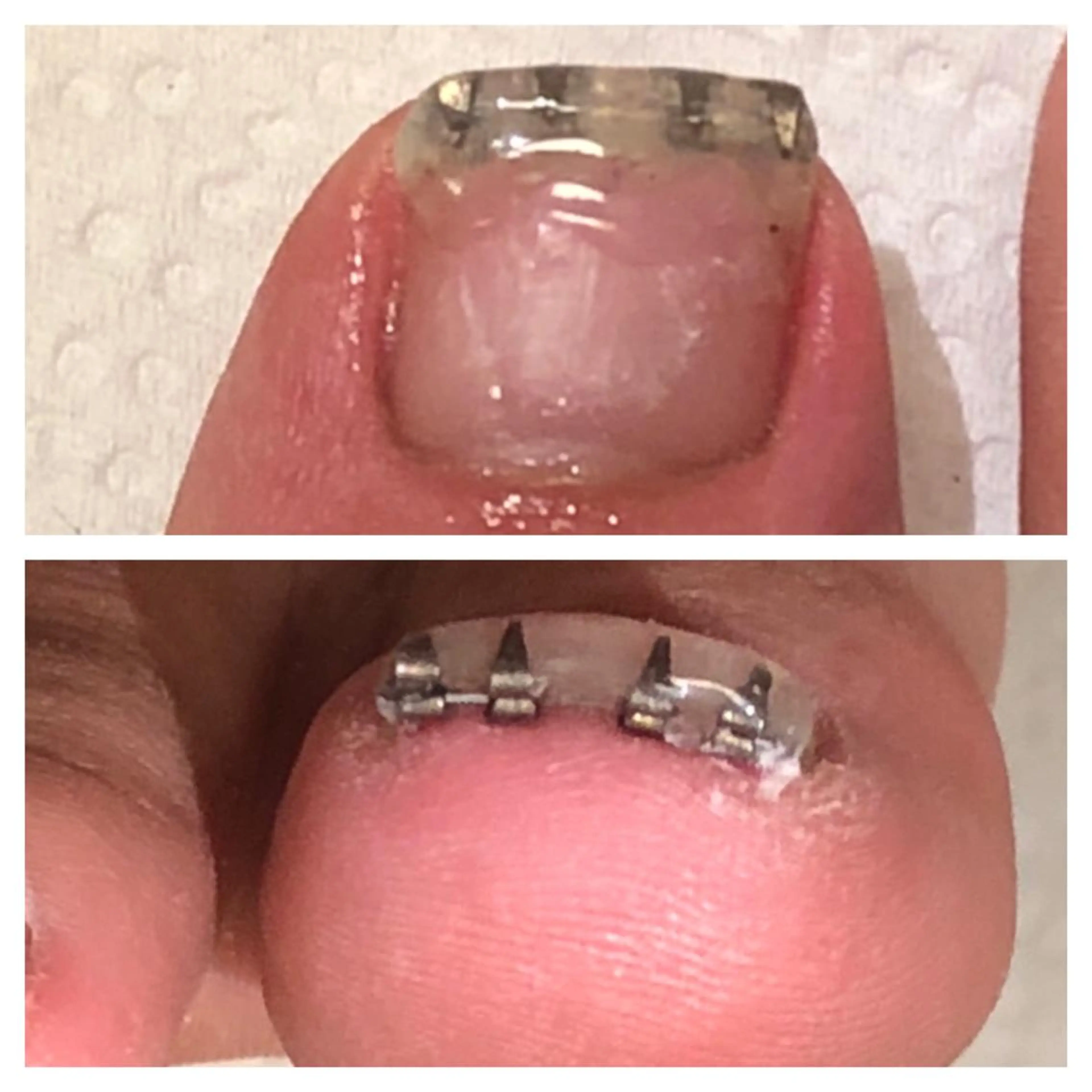 メンズ ネイル アートネイル クリアネイル ジェルネイル 🌱 ま し お 🌱のその他イメージ