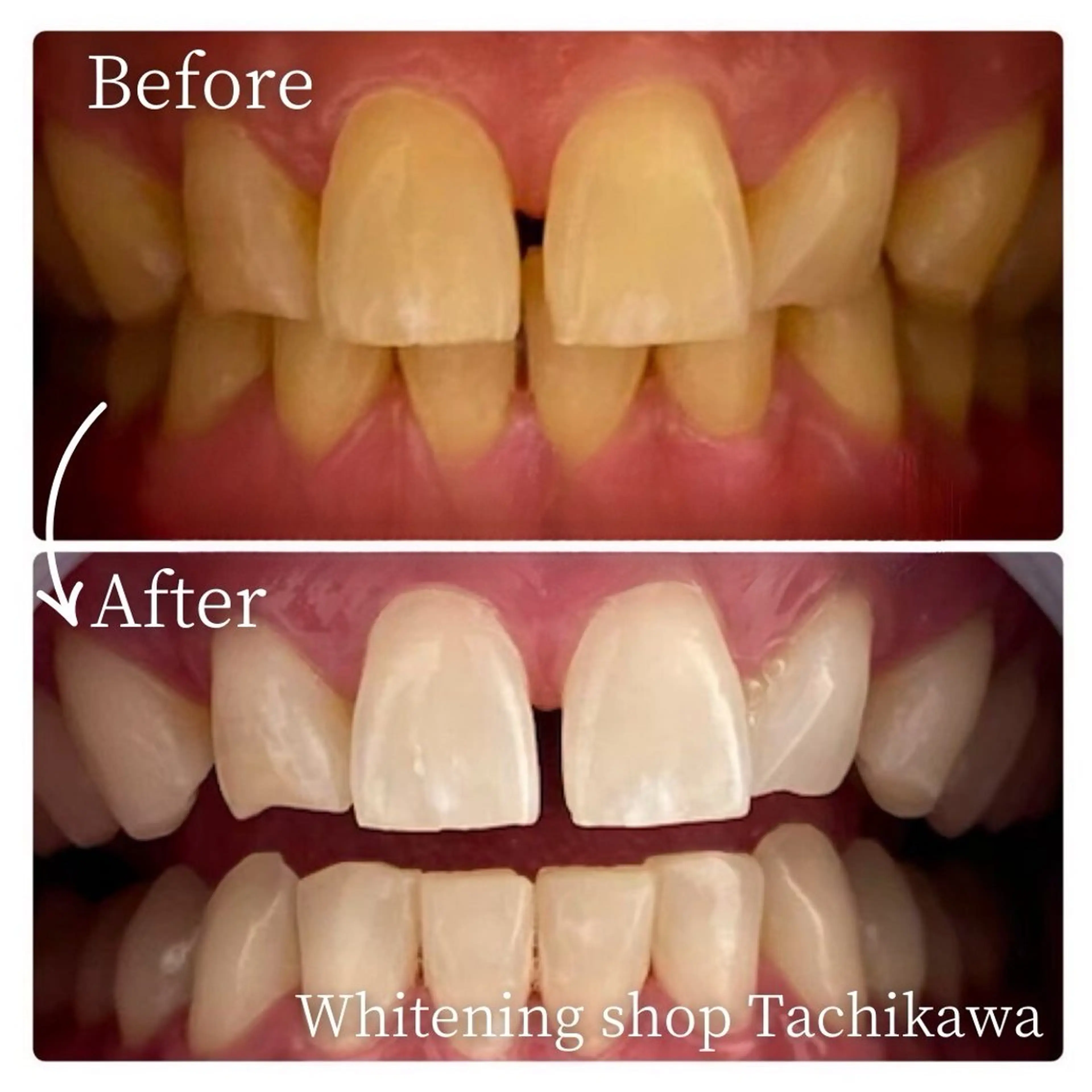 セルフ ホワイト ニングショップ立川のその他イメージ