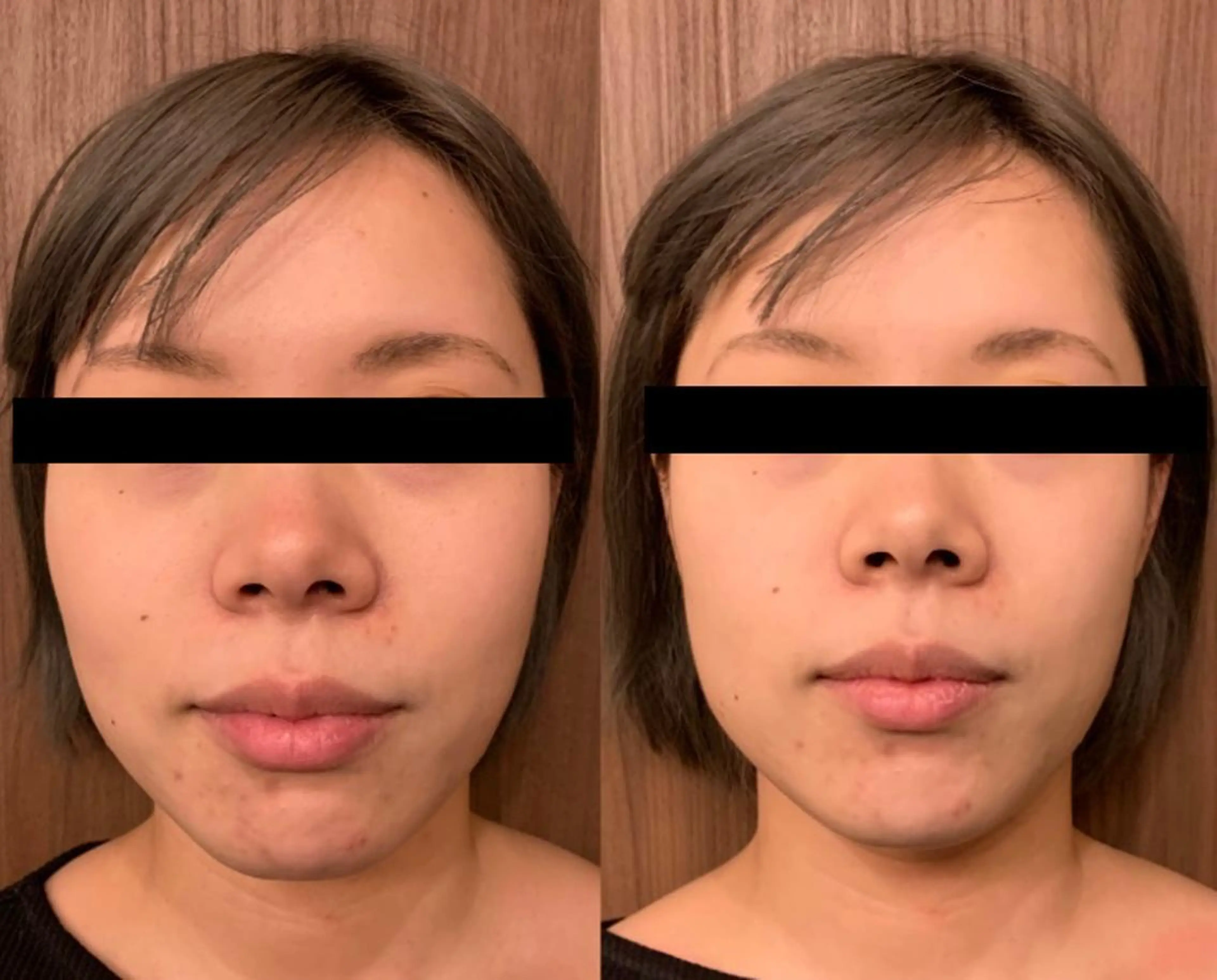 姿勢・体質・自律神経 ケアサロンCOTOのエステ・リラクイメージ