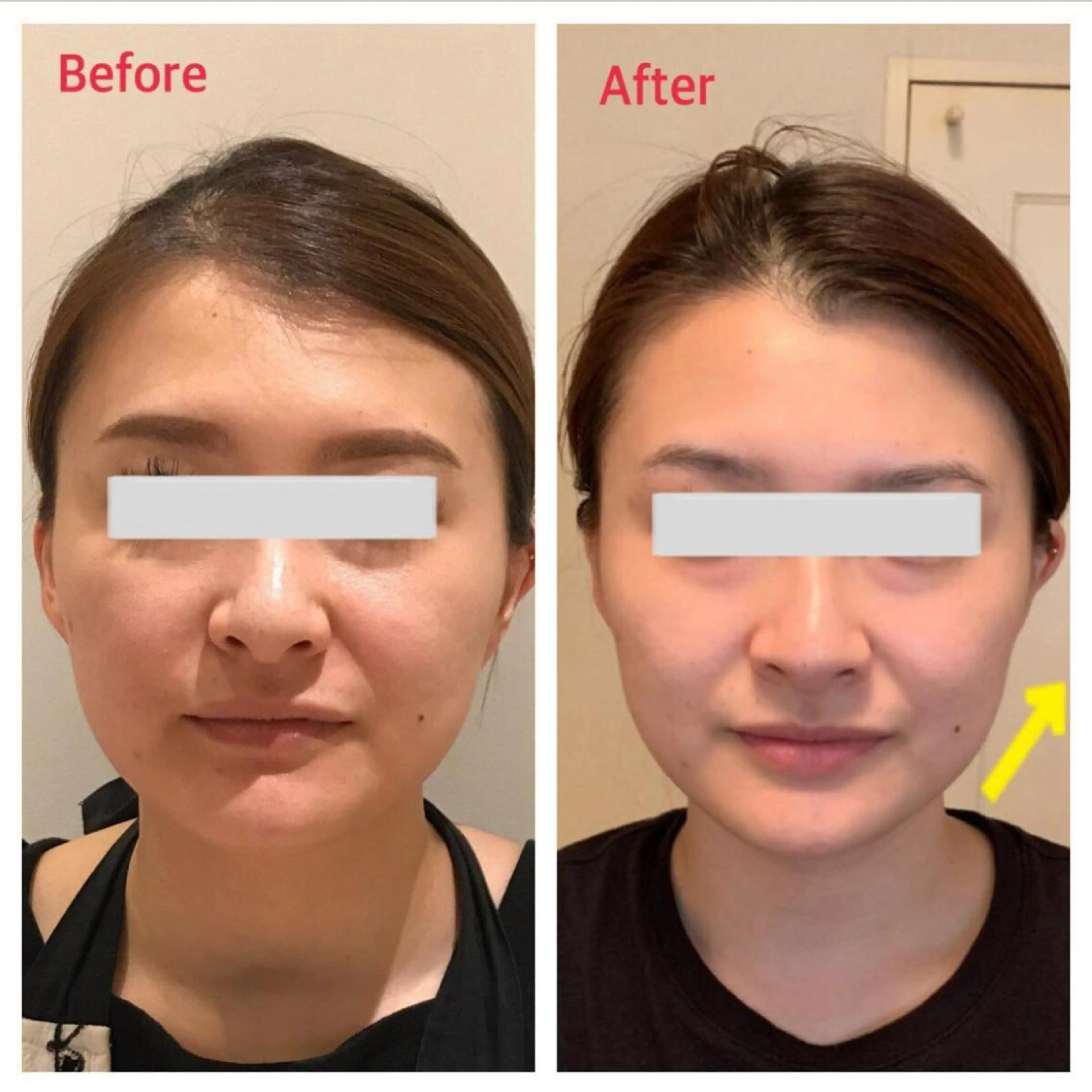 エステ ENCHANT 脱毛.小顔.毛穴のエステ・リラクイメージ