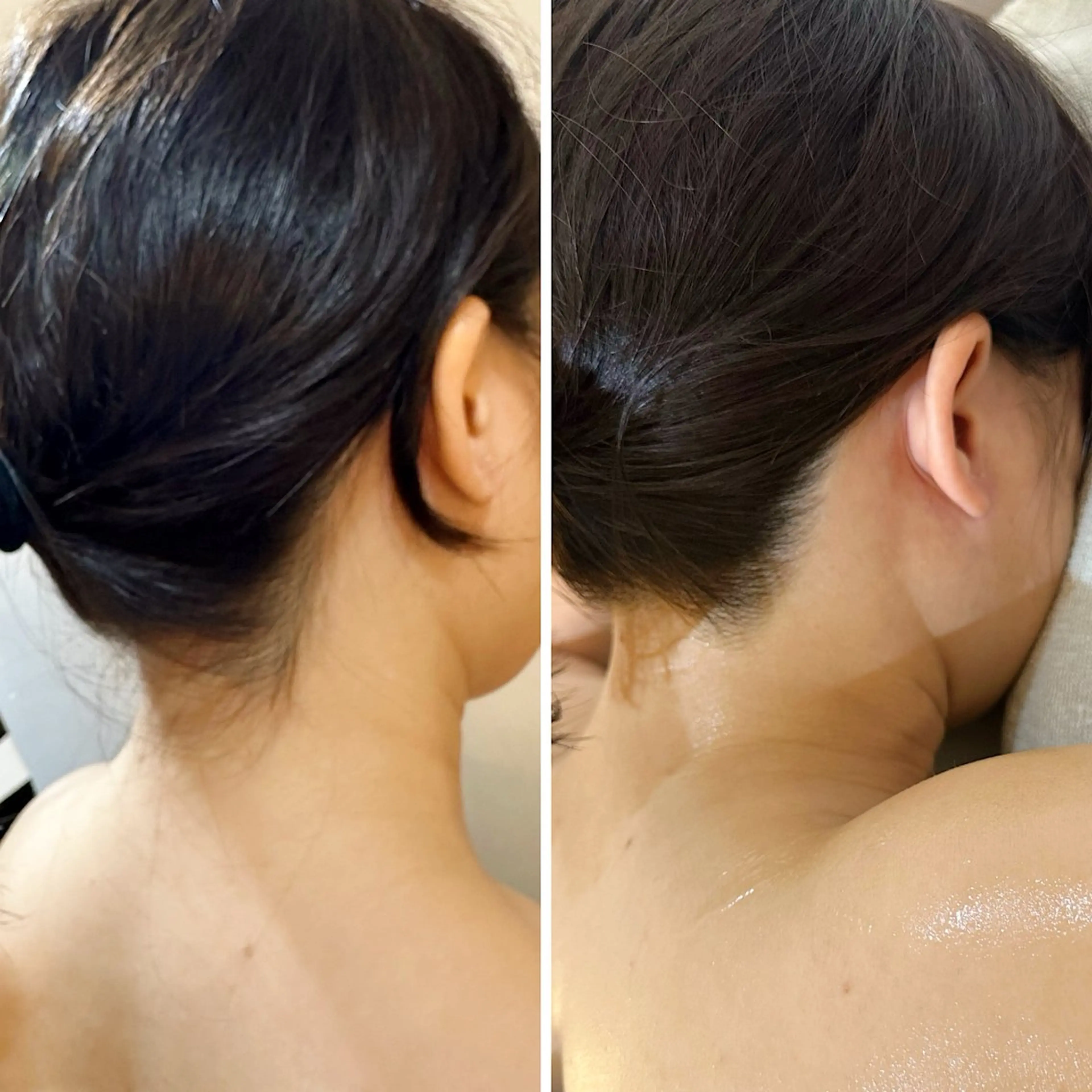 うなじ脱毛/美肌脱毛 LABELのエステ・リラクイメージ