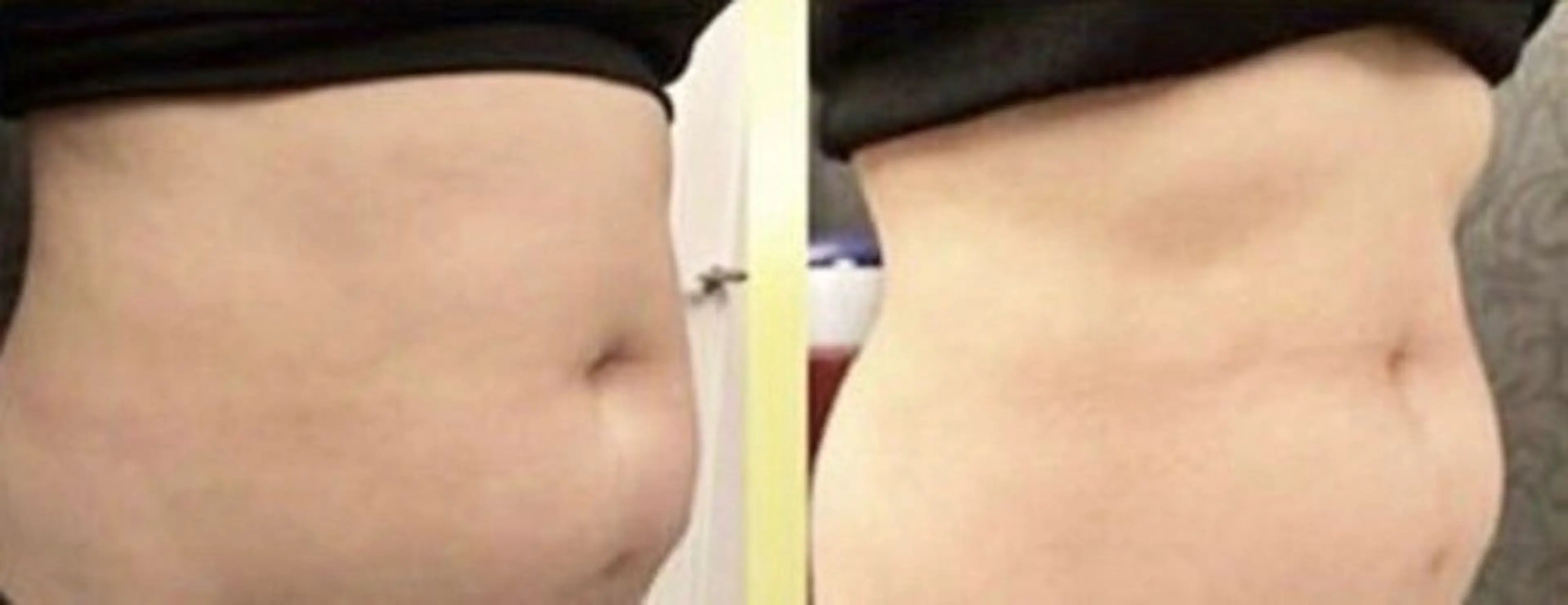 カルミア心斎橋店🌸 【痩身・小顔・美肌】のエステ・リラクイメージ