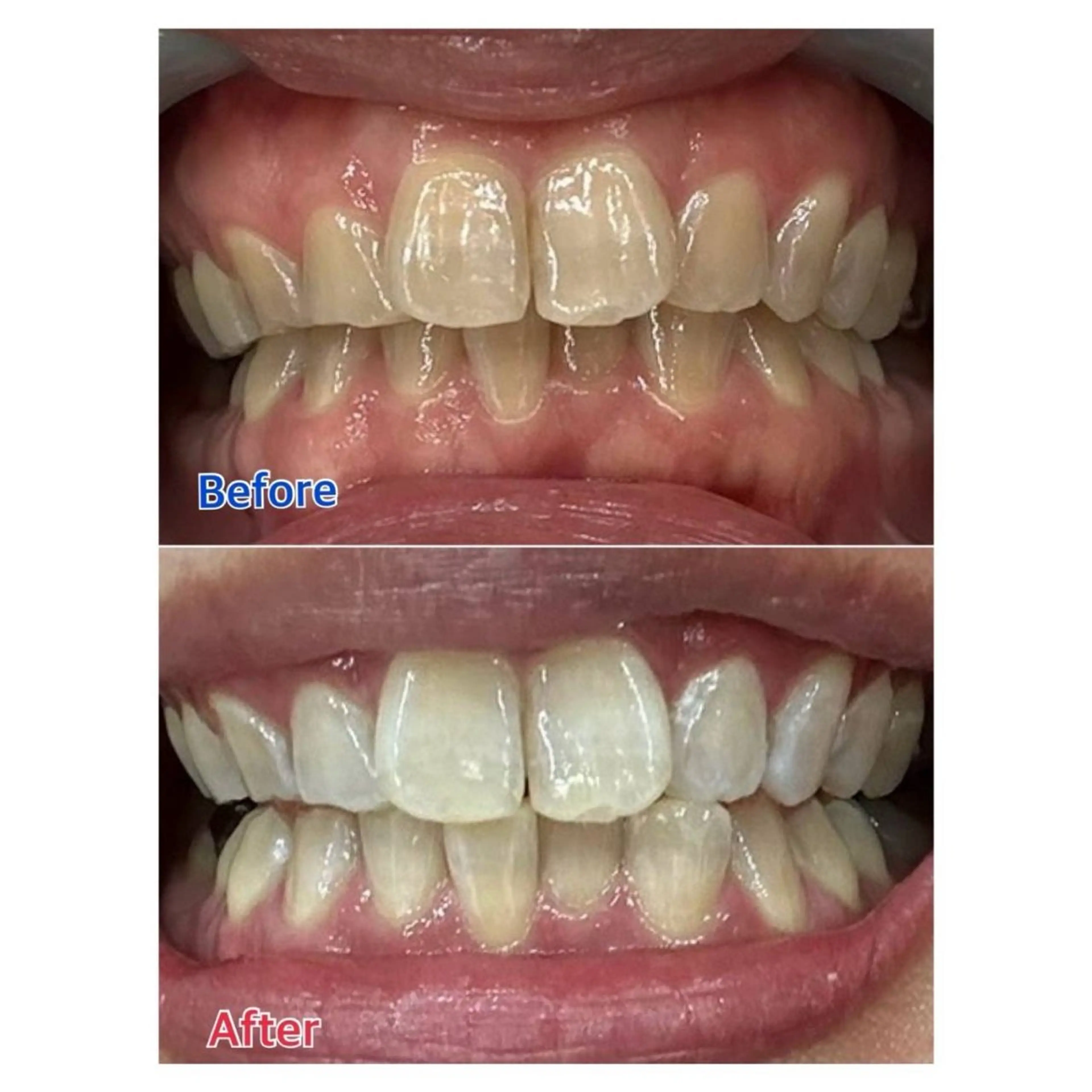 Melty 輝のその他イメージ