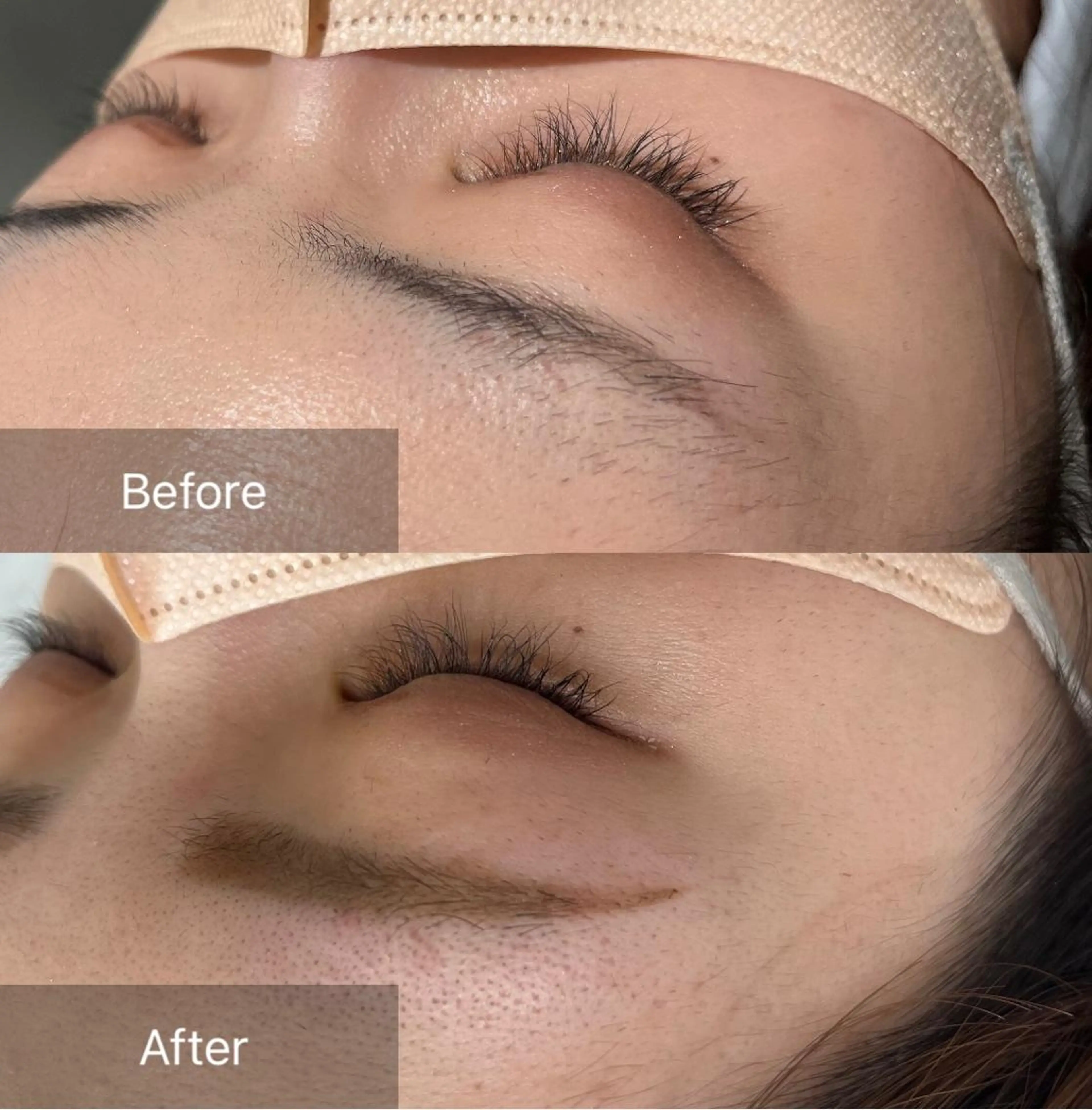 アイブロウ for woman所属・森 美優のエステ・リラクイメージ