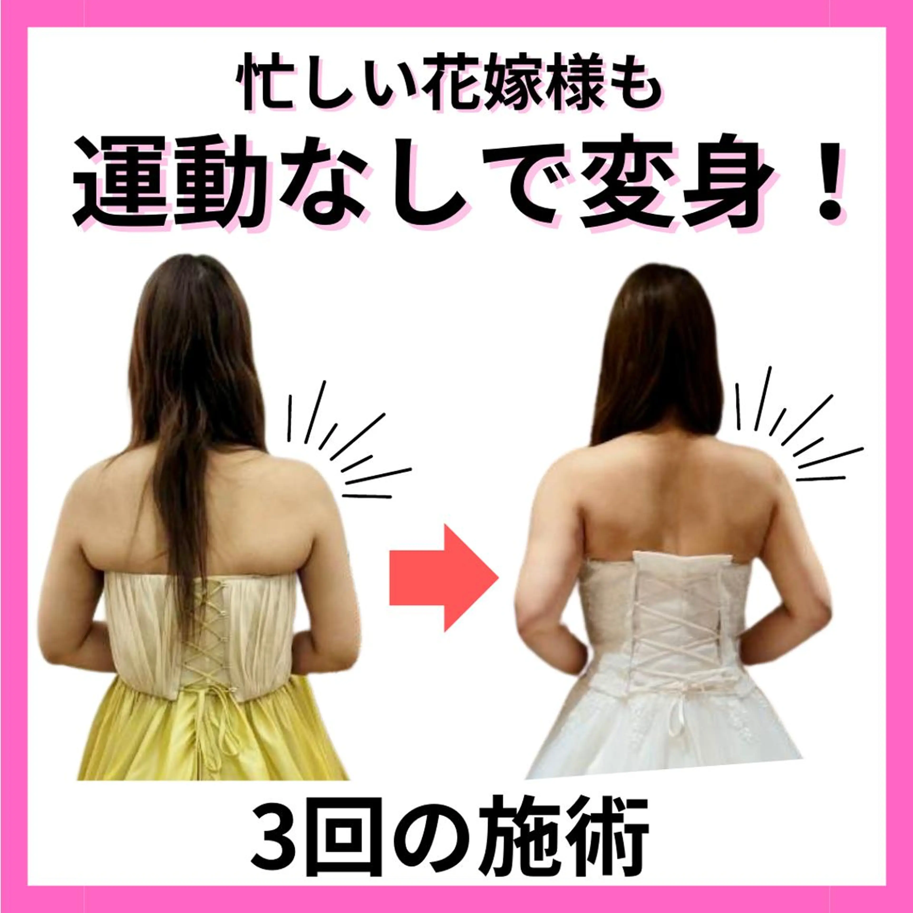 ミディアム カラー パーマ ヘアアレンジ メンズ キッズ ネイル マツエク・マツパ アイブロウ 結婚式・ブライダル 結婚式・ブライダル ブライダルネイル さくら夙川駅徒歩3分 最新韓国施術|脚やせのエステ・リラクイメージ