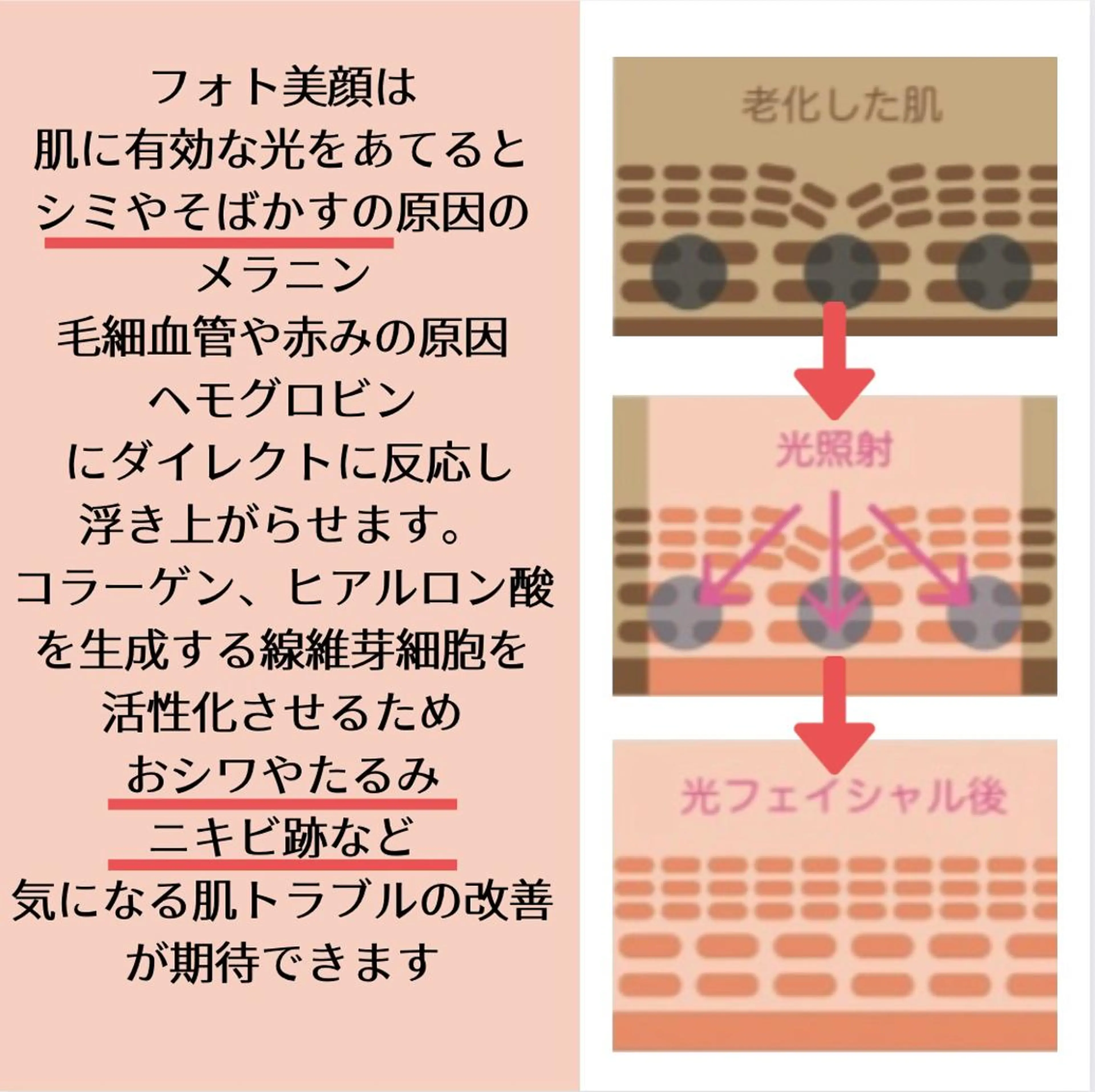 メンズ STELLAR. 谷岡恵里香のエステ・リラクイメージ