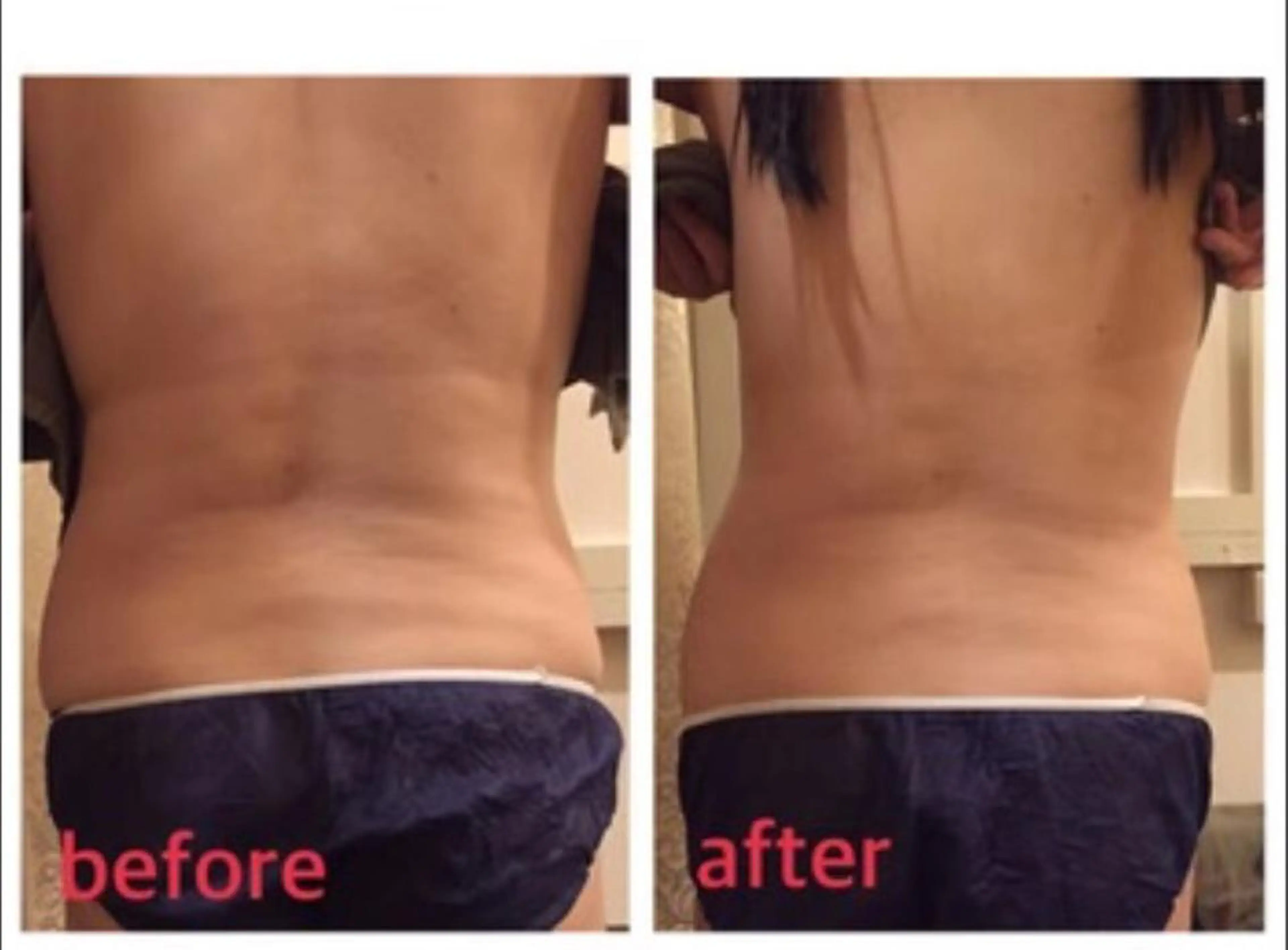 エステ リラクゼーション ルナのエステ・リラクイメージ