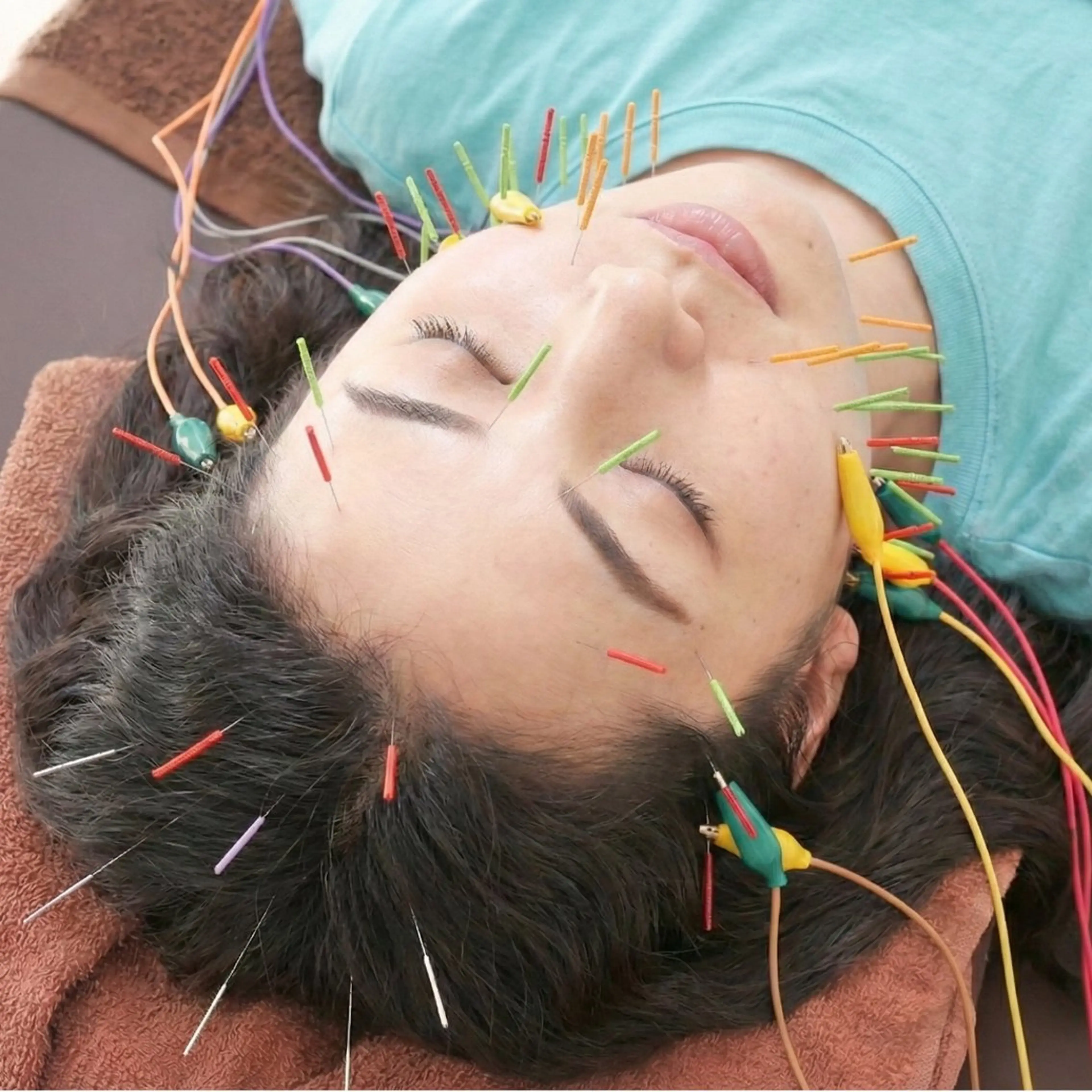 美容鍼DAZZLE マスザキのエステ・リラクイメージ