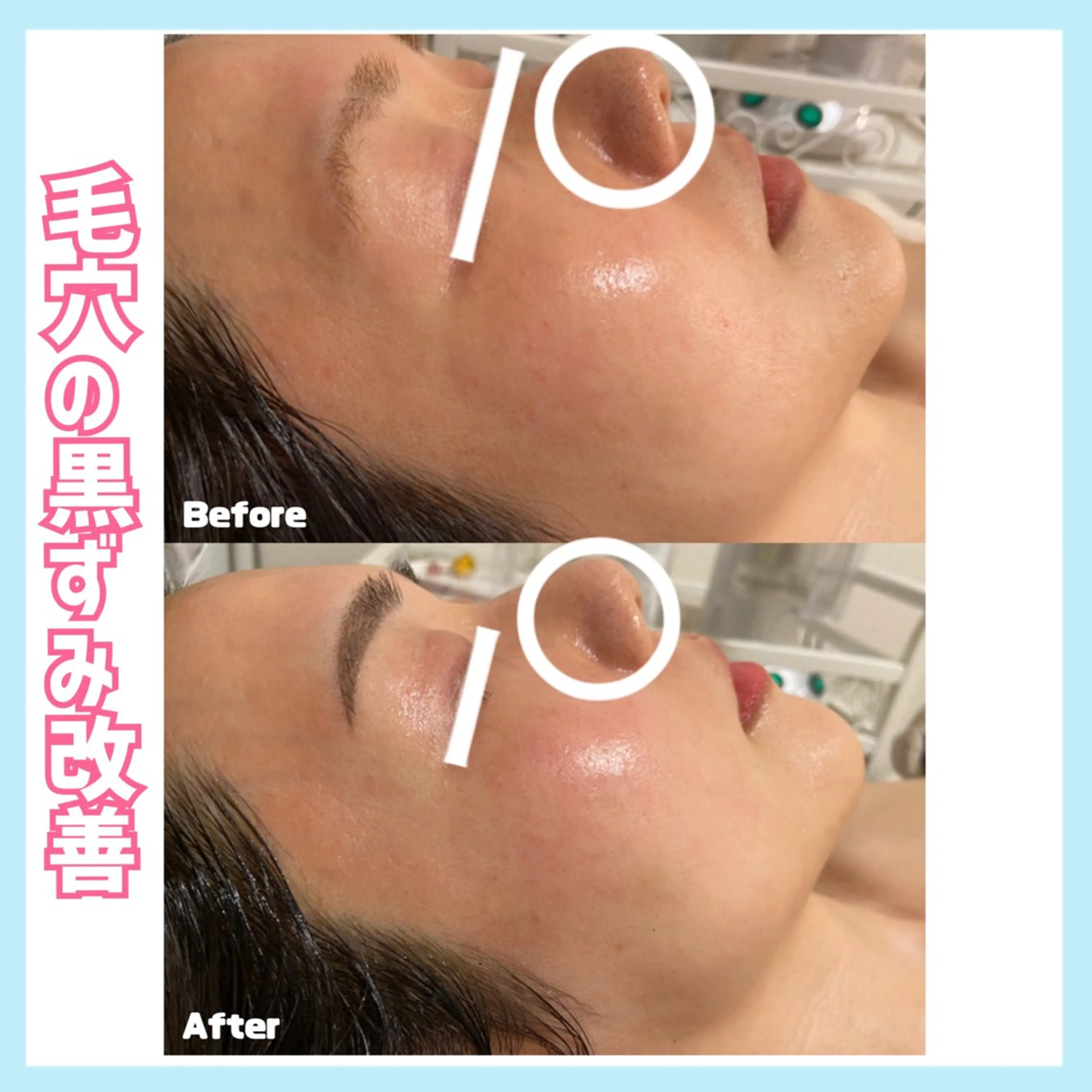 エステ オールハンド専門🤍 痩身/小顔/ ハーブのエステ・リラクイメージ