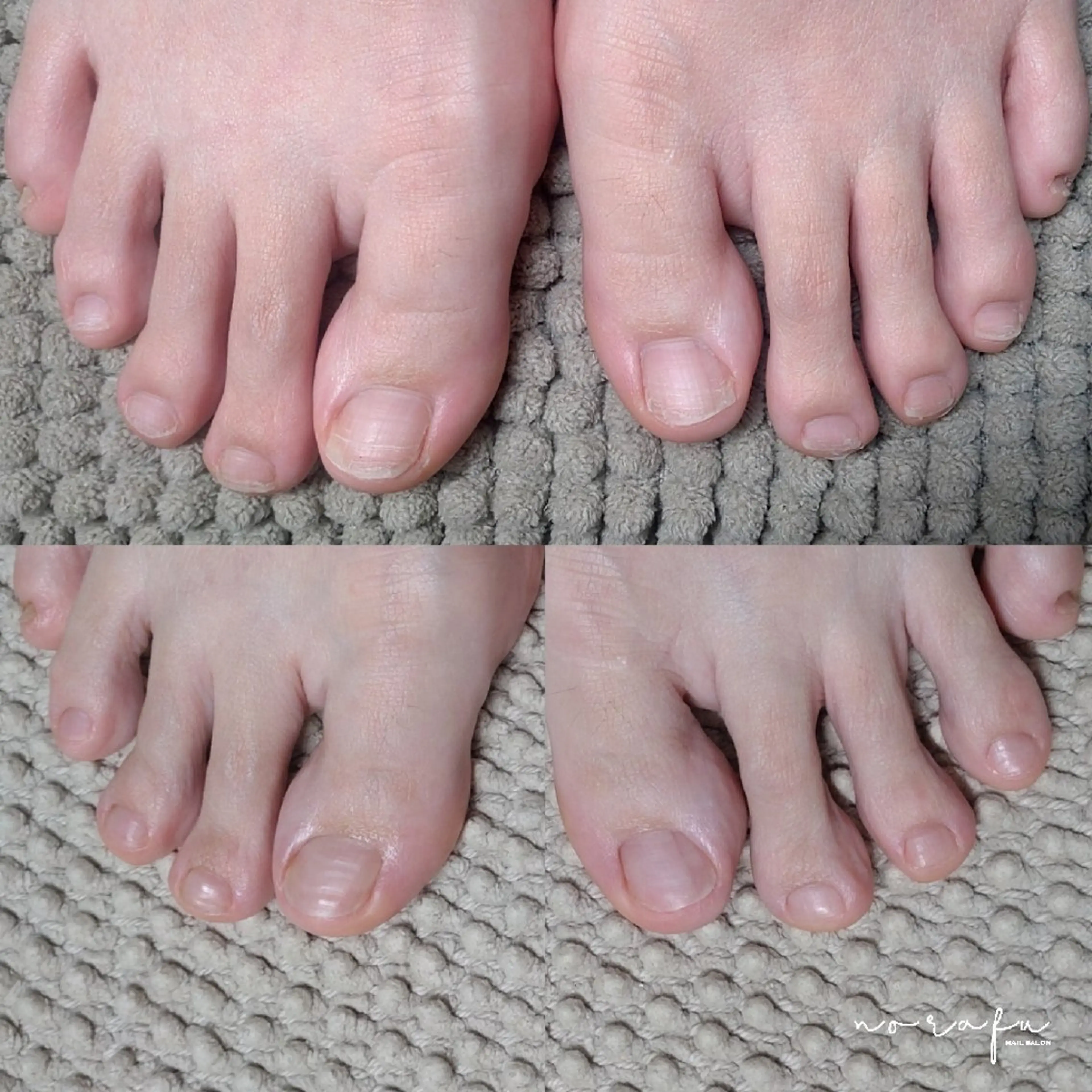 ネイル フットネイル nail 　norafu.のネイルデザイン