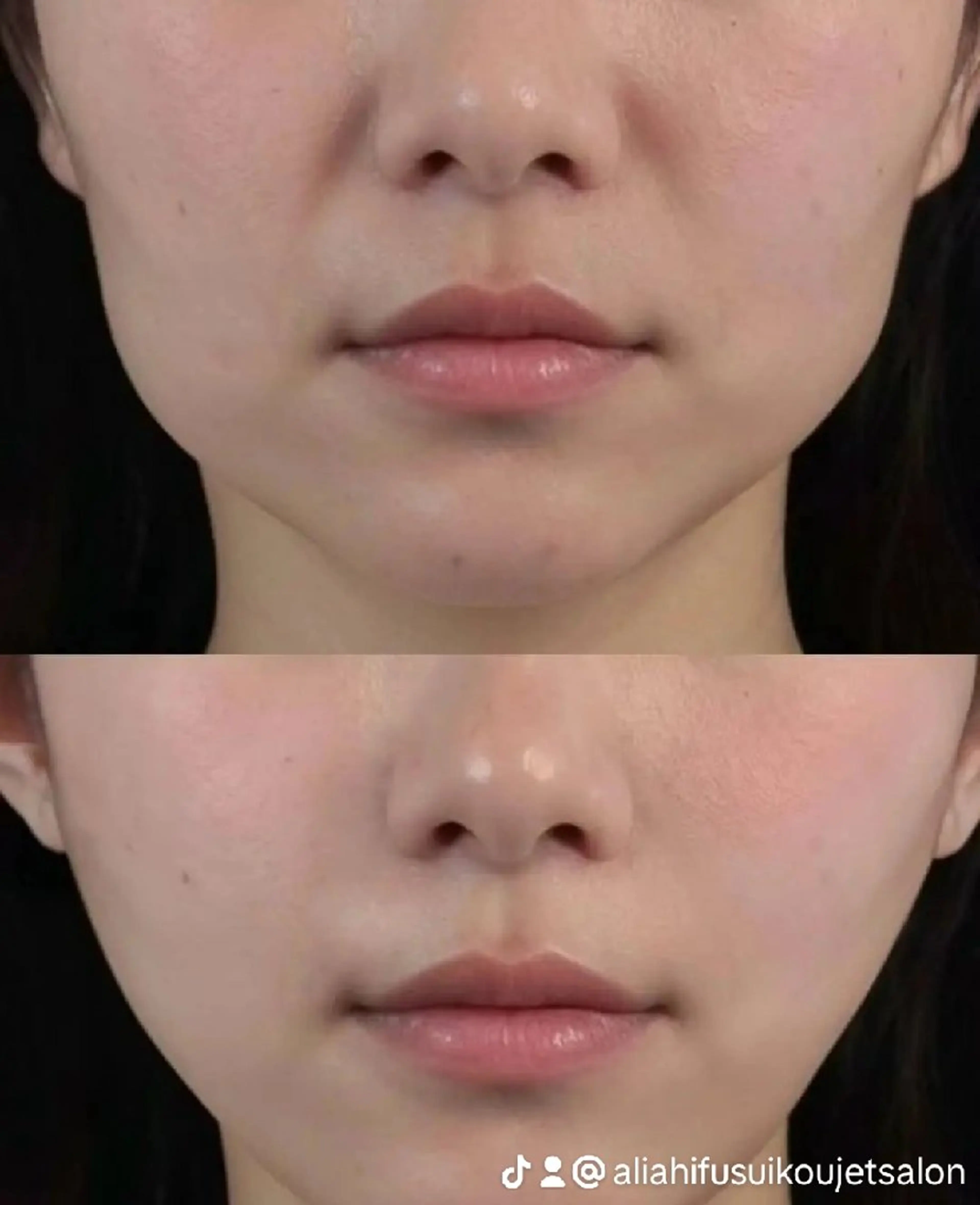 マツエク・マツパ 結婚式・ブライダル aliaハーブ水光店 エステティシャン募集のエステ・リラクイメージ