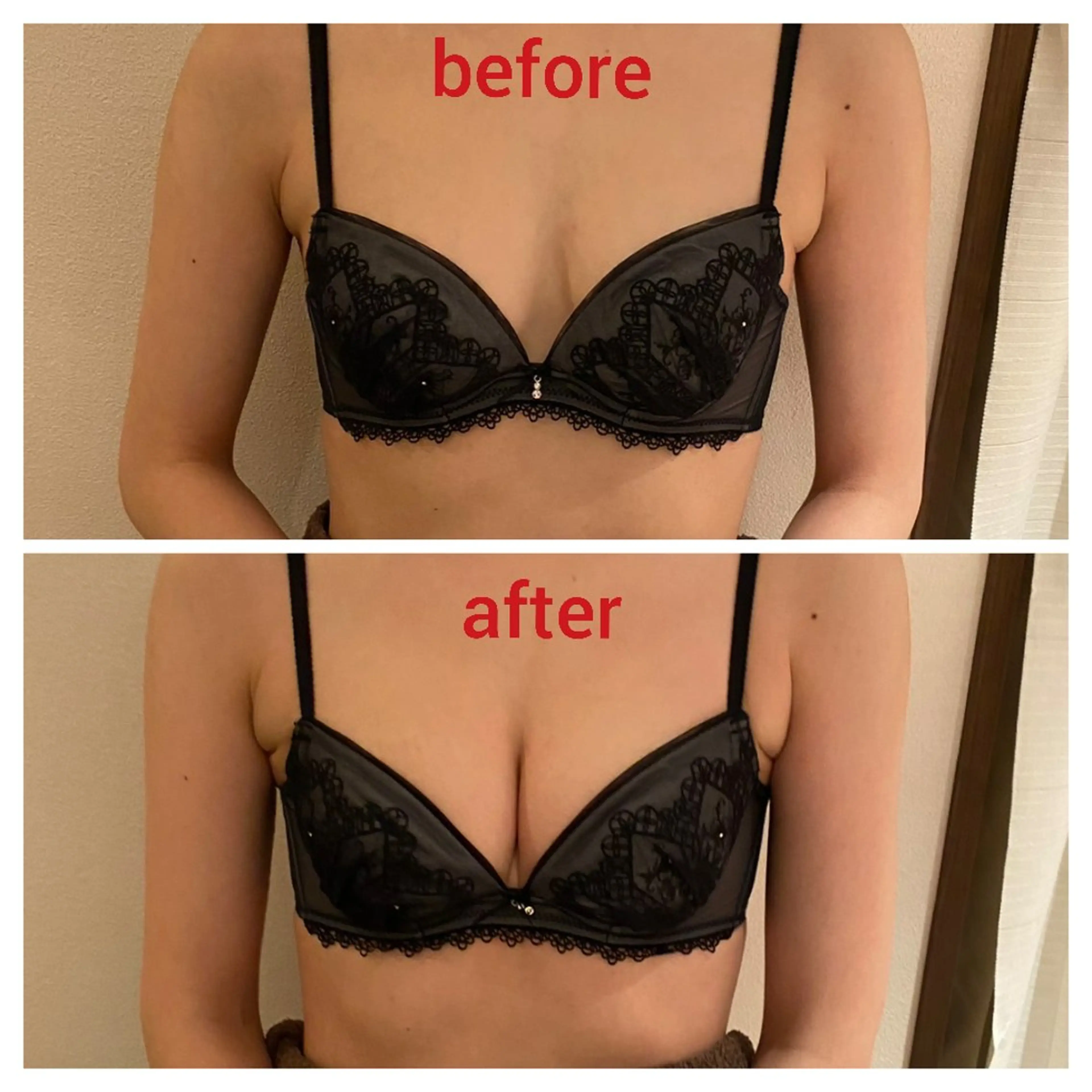 【人気No.1☆ビフォーアフターモデル】バストアップ育乳マッサージ+マシーンのスペシャルコースの写真