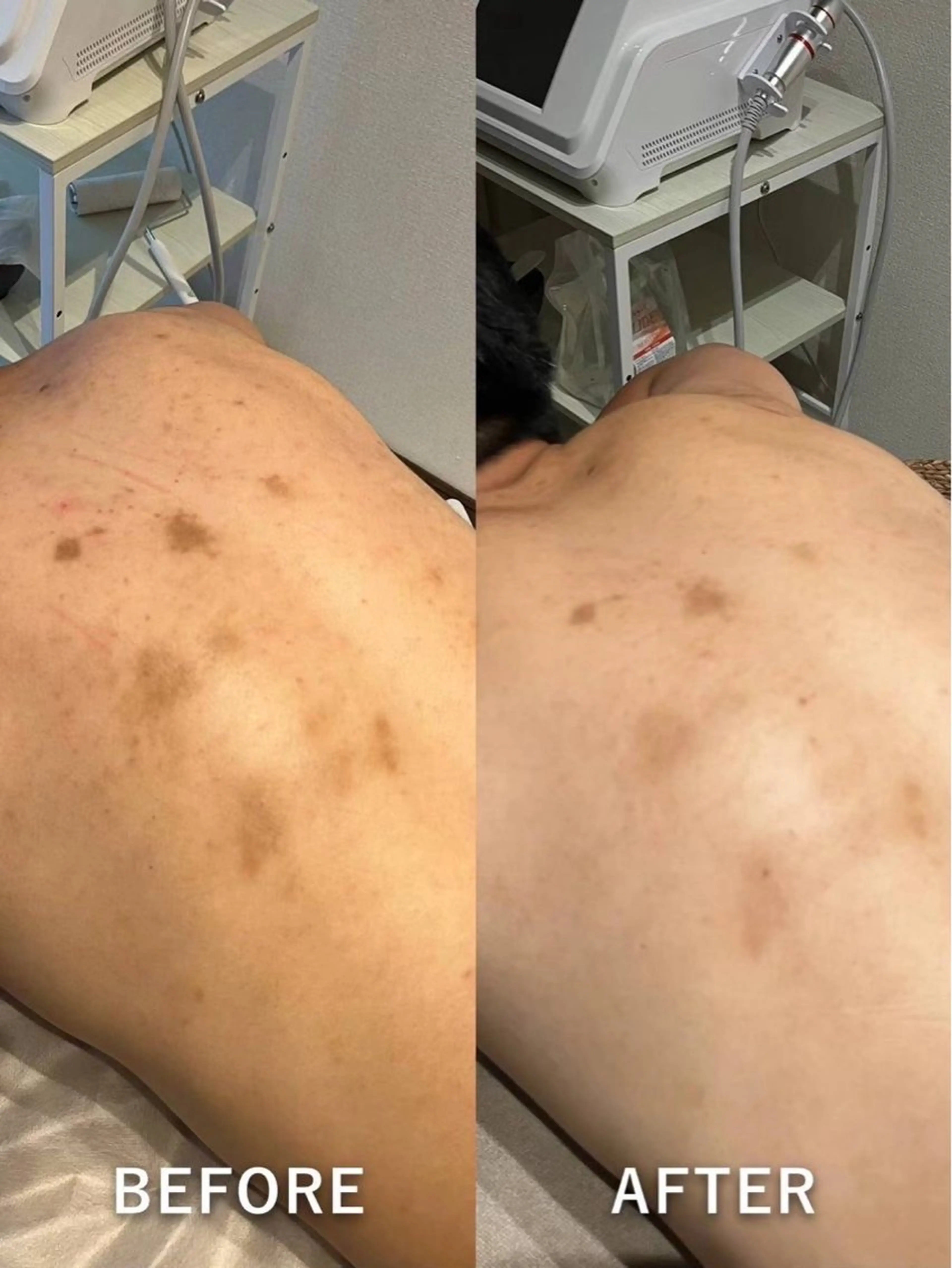 # fu♡のエステ・リラクイメージ