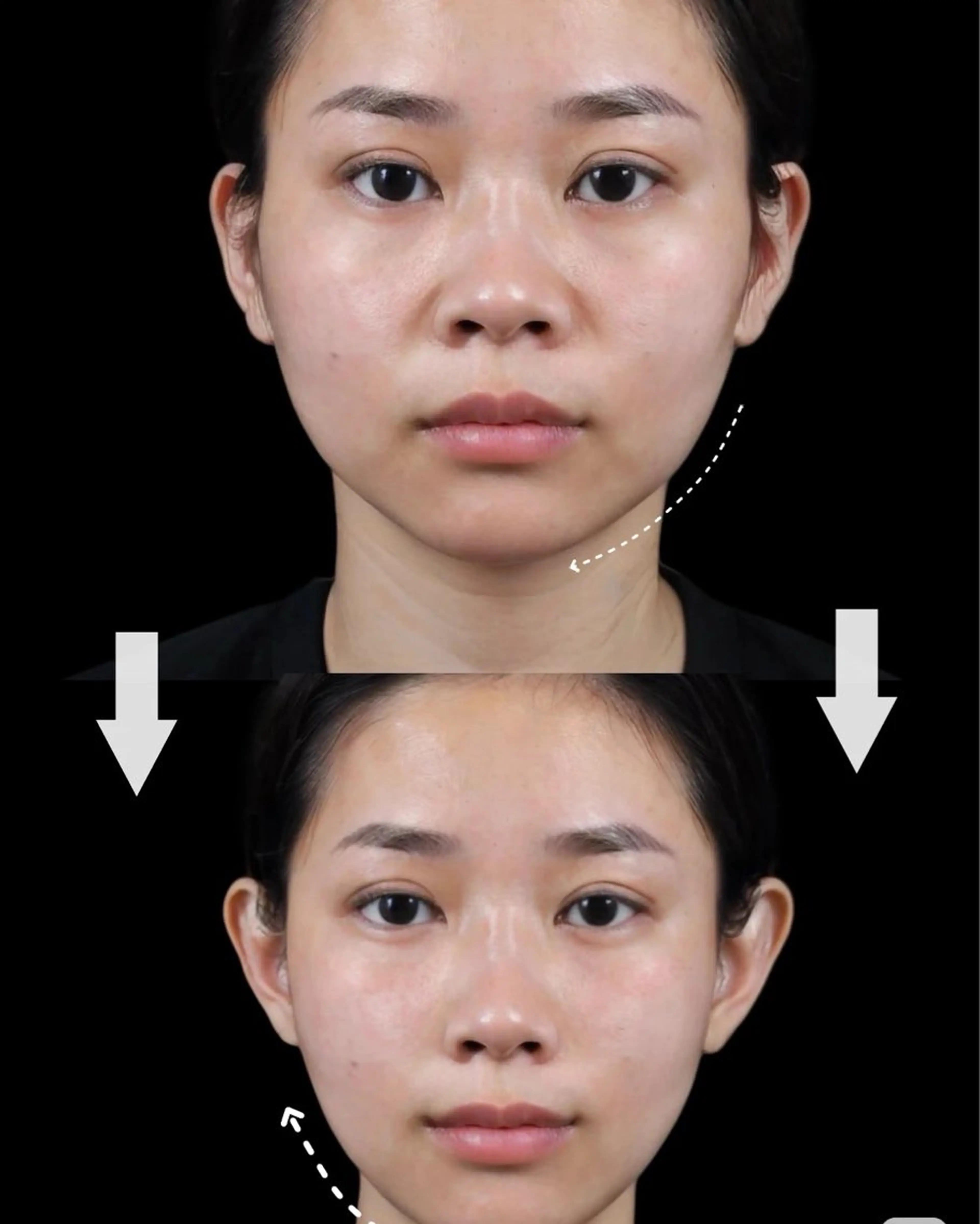 マツエク・マツパ エステ aliaハイフ&水光ジェットサロン所属・aliaハーブ水光店 エステティシャン募集のエステ・リラクイメージ