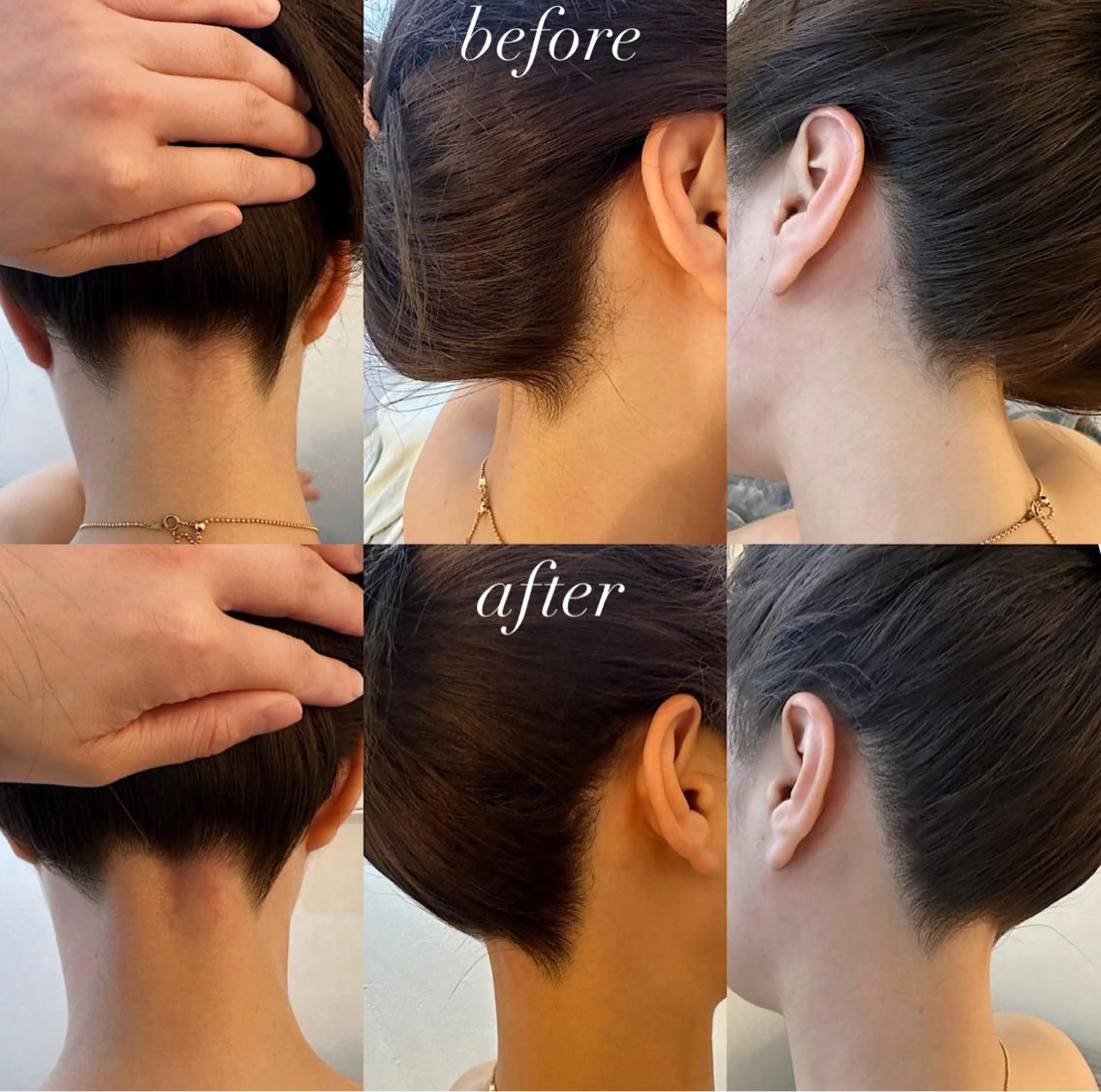 うなじ脱毛/美肌脱毛 LABELのエステ・リラクイメージ