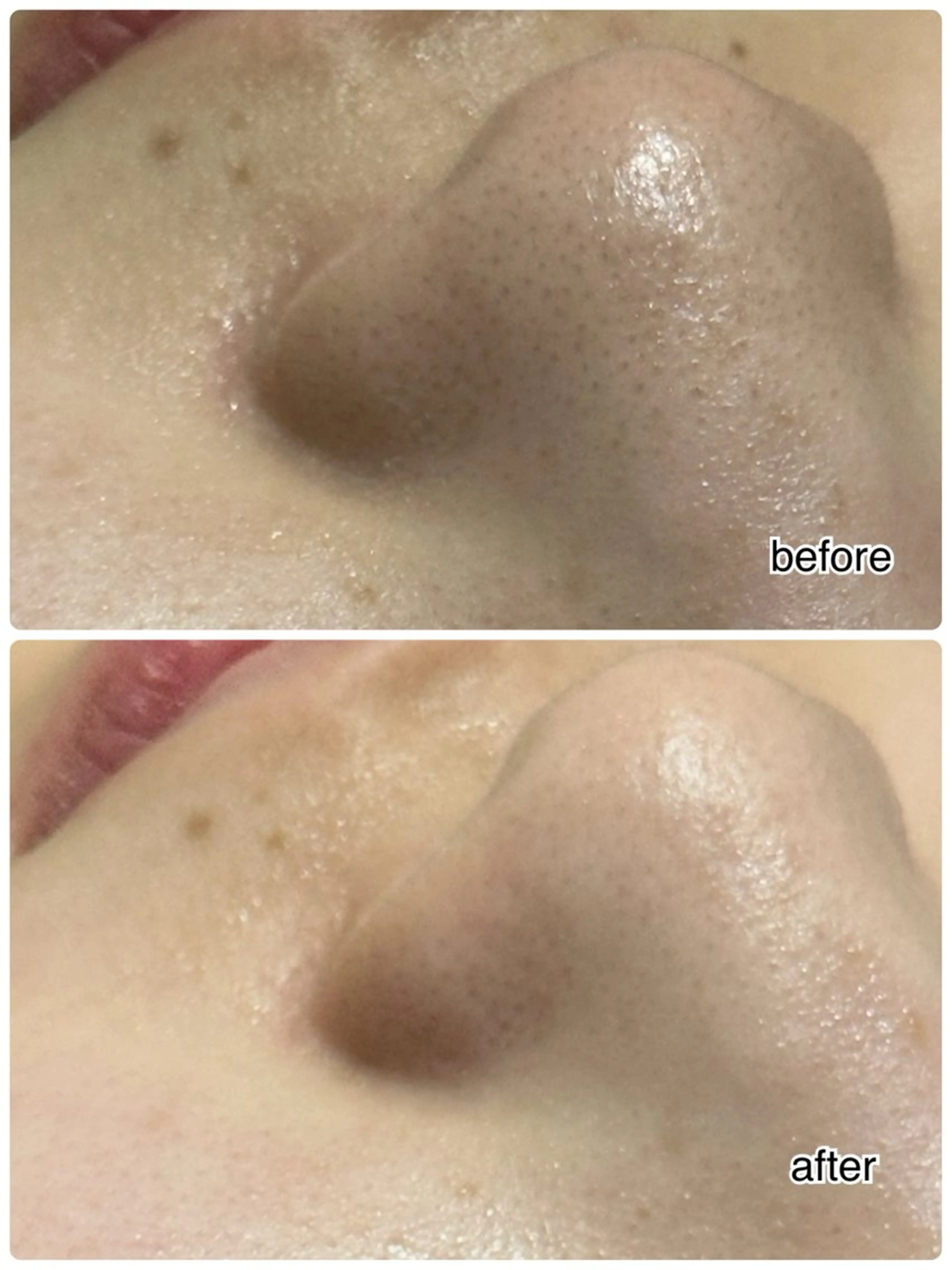 エステ ENCHANT 脱毛.小顔.毛穴のエステ・リラクイメージ