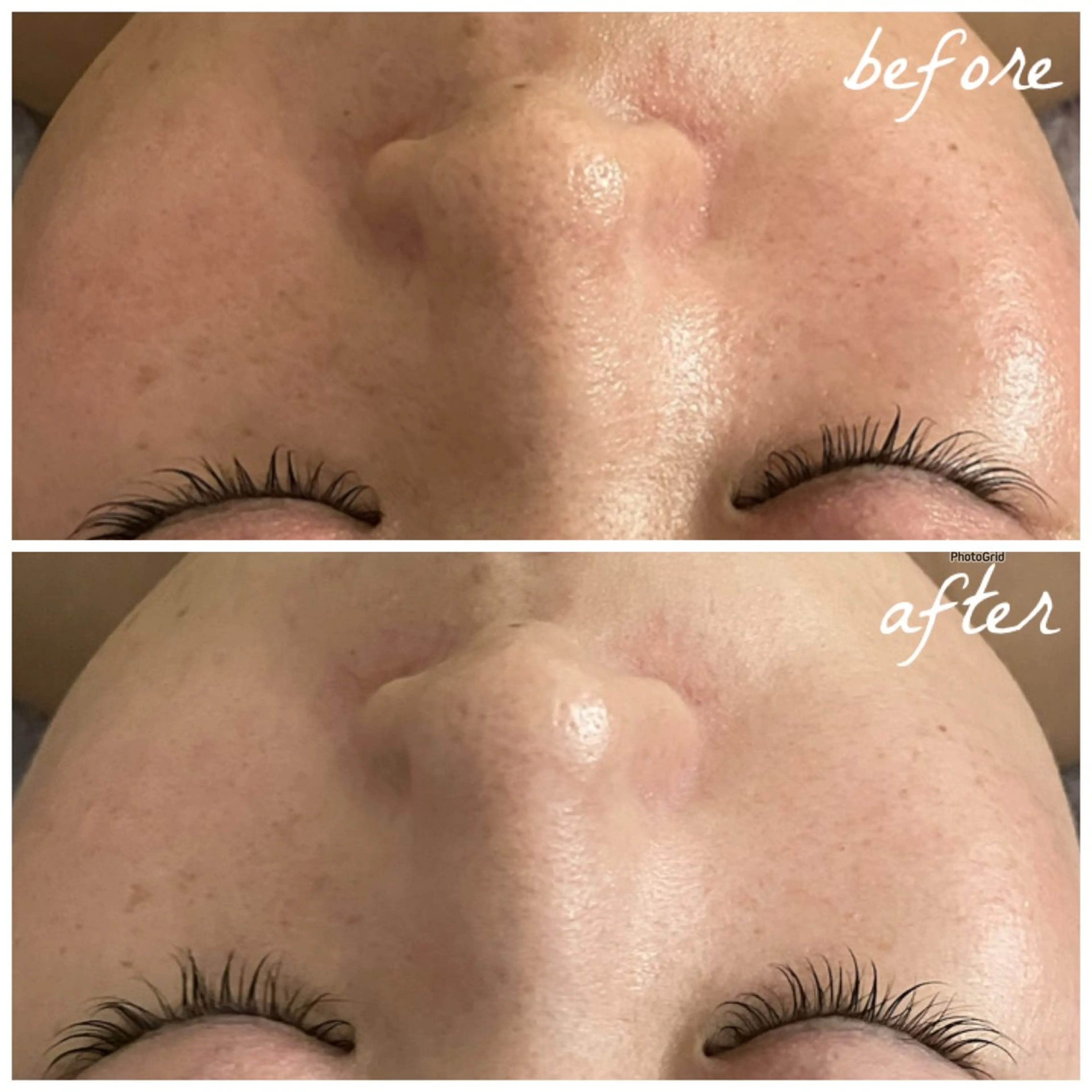 メンズ エステ メナード岐阜茜部 杉浦のエステ・リラクイメージ