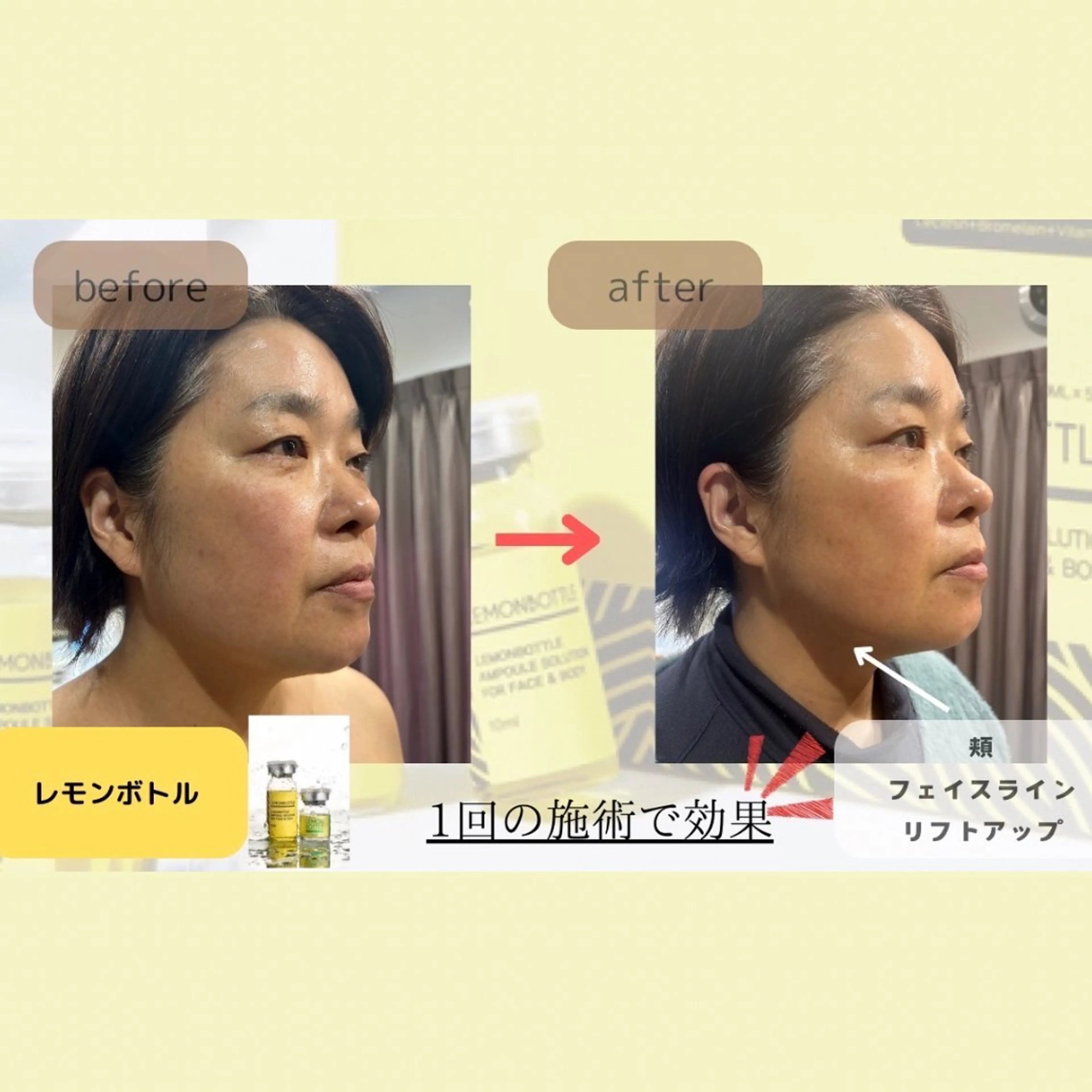 【新規限定】フェイスライン集中ケア もたつき印象をスッキリ見せたい方にの写真