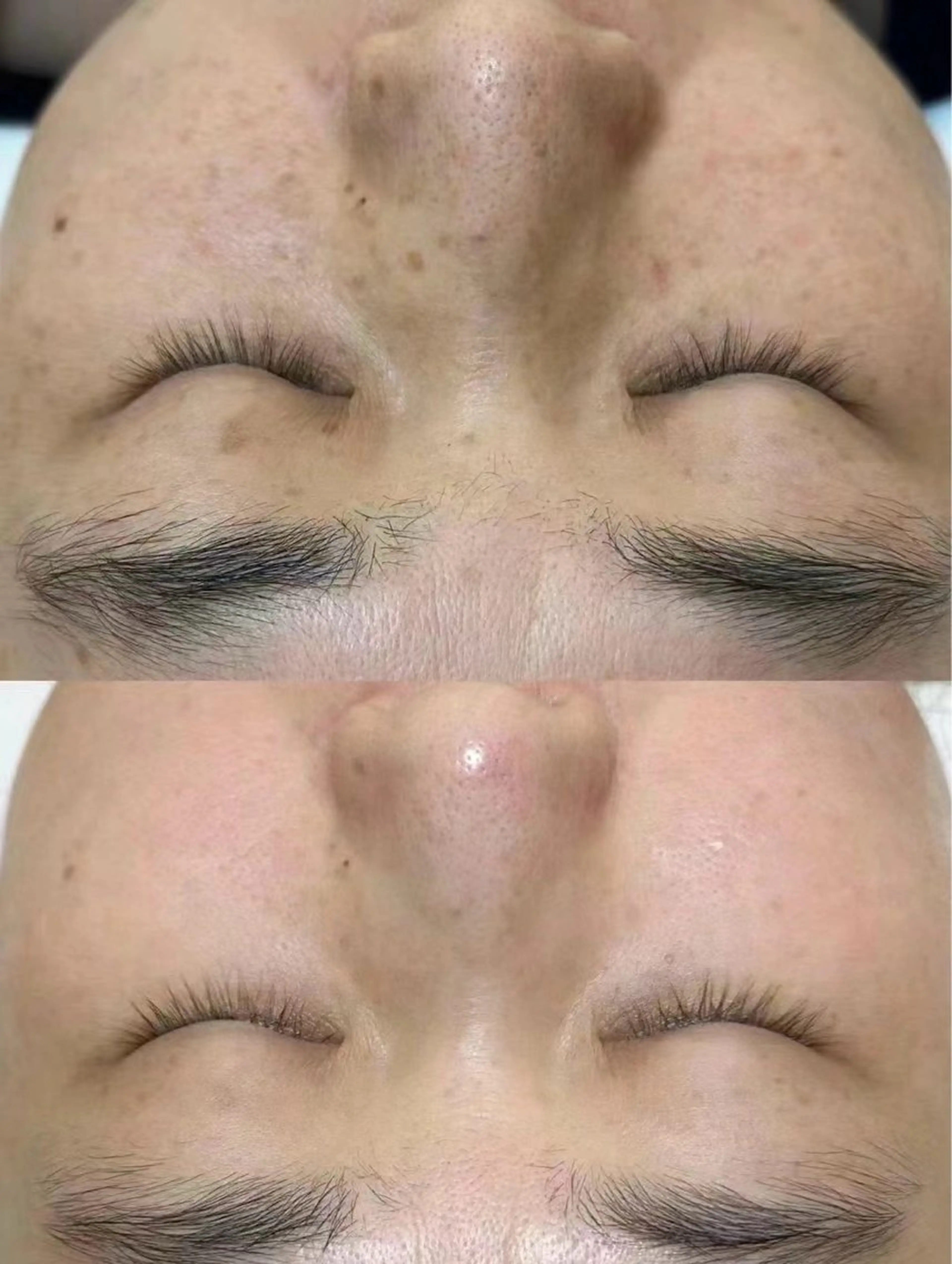 エステ 愛維美水光美肌専門店 メンズレディースokのエステ・リラクイメージ