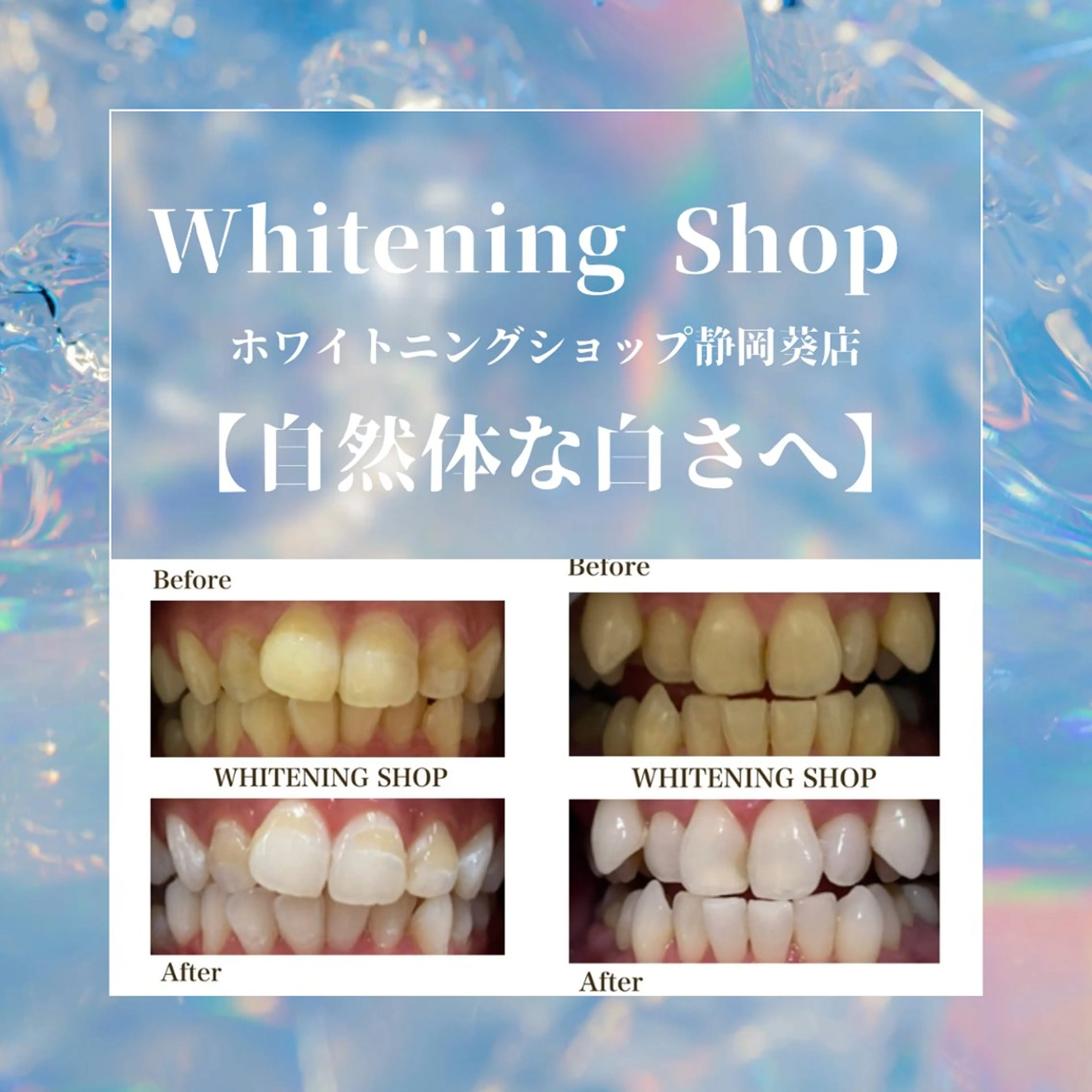 ホワイトニングショップ静岡葵区店所属・ホワイトニング ショップ葵区静岡駅店のその他イメージ