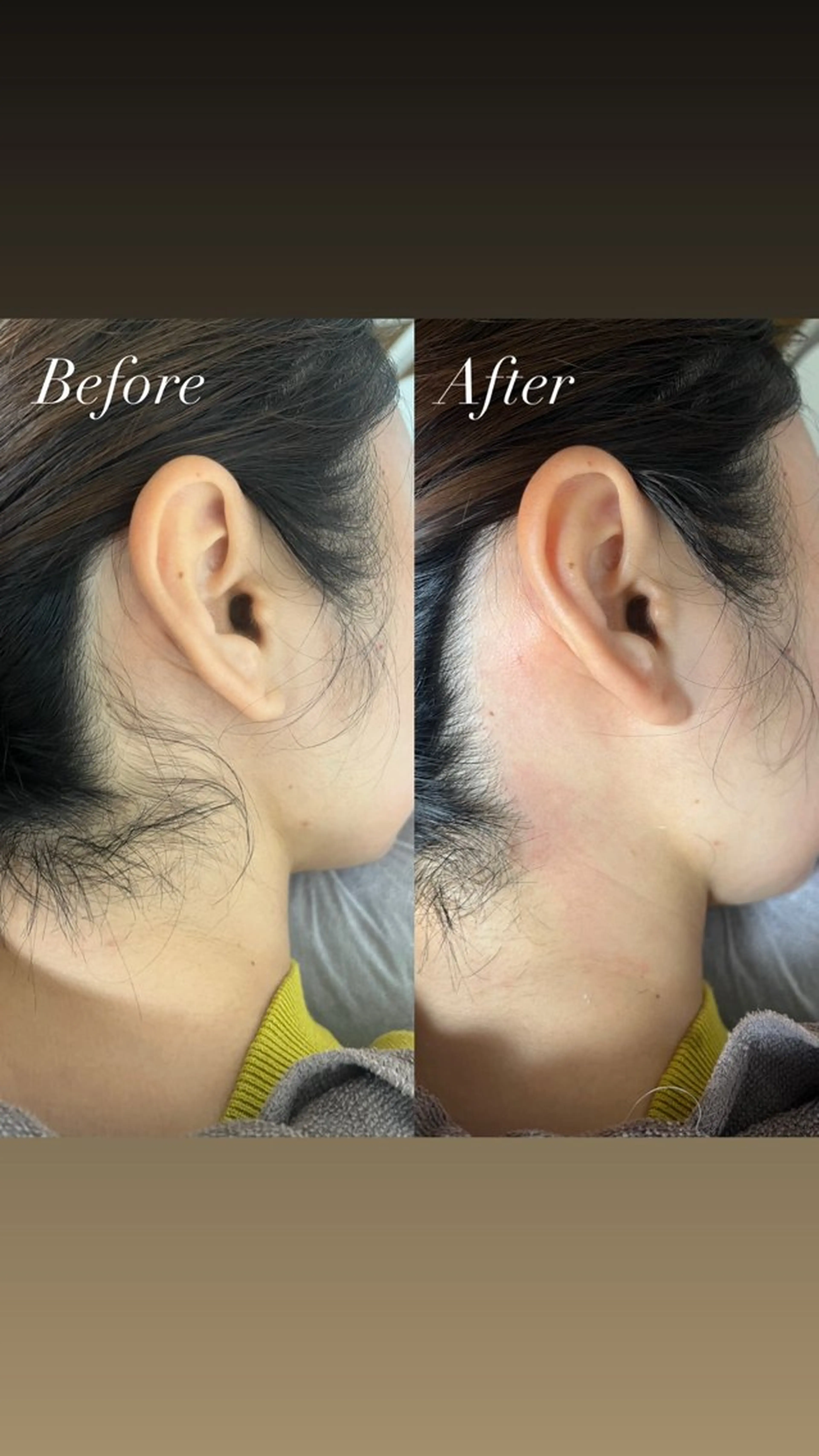 脱毛 LULA大宮店 WATANABEのエステ・リラクイメージ