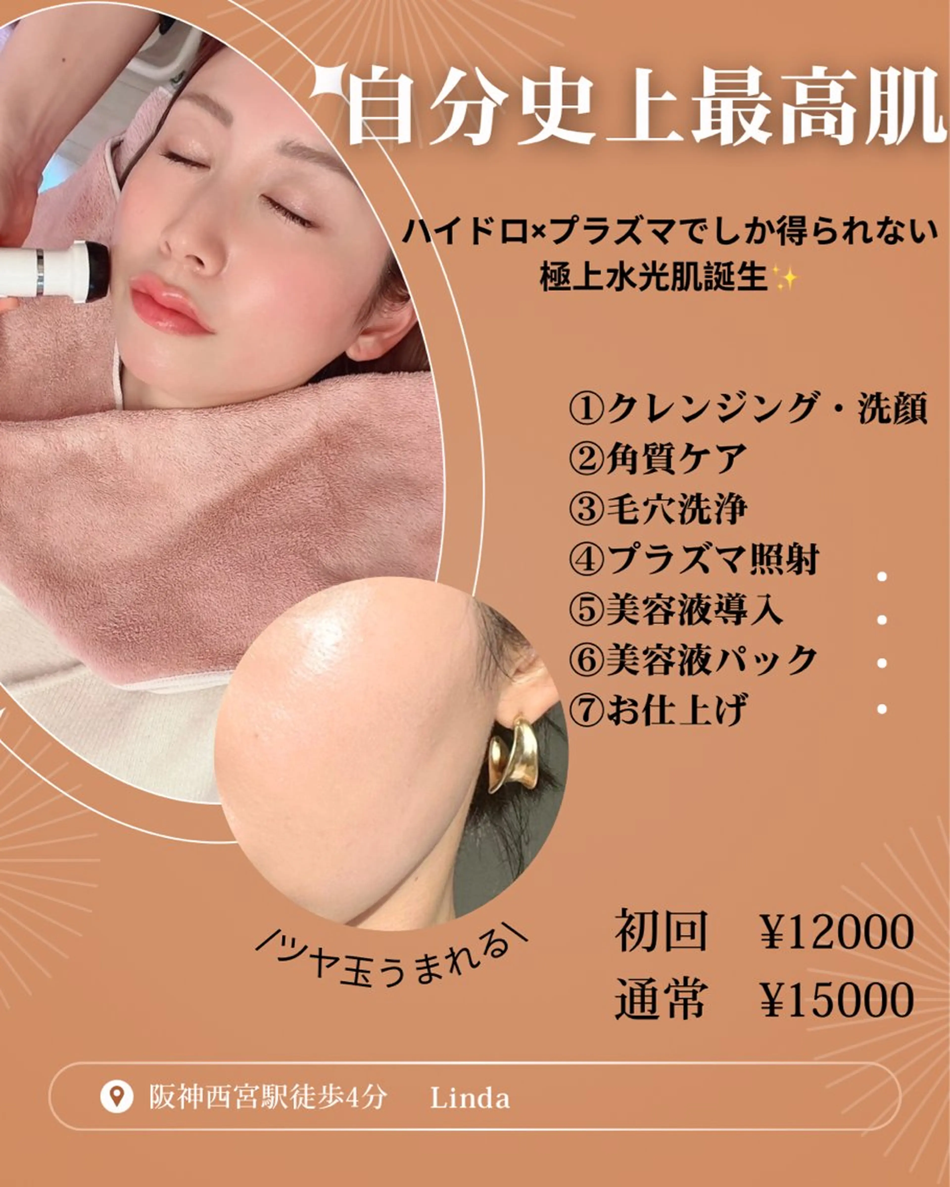 エステ 小顔&毛穴・肌質改善 LINDA西宮 AIのエステ・リラクイメージ