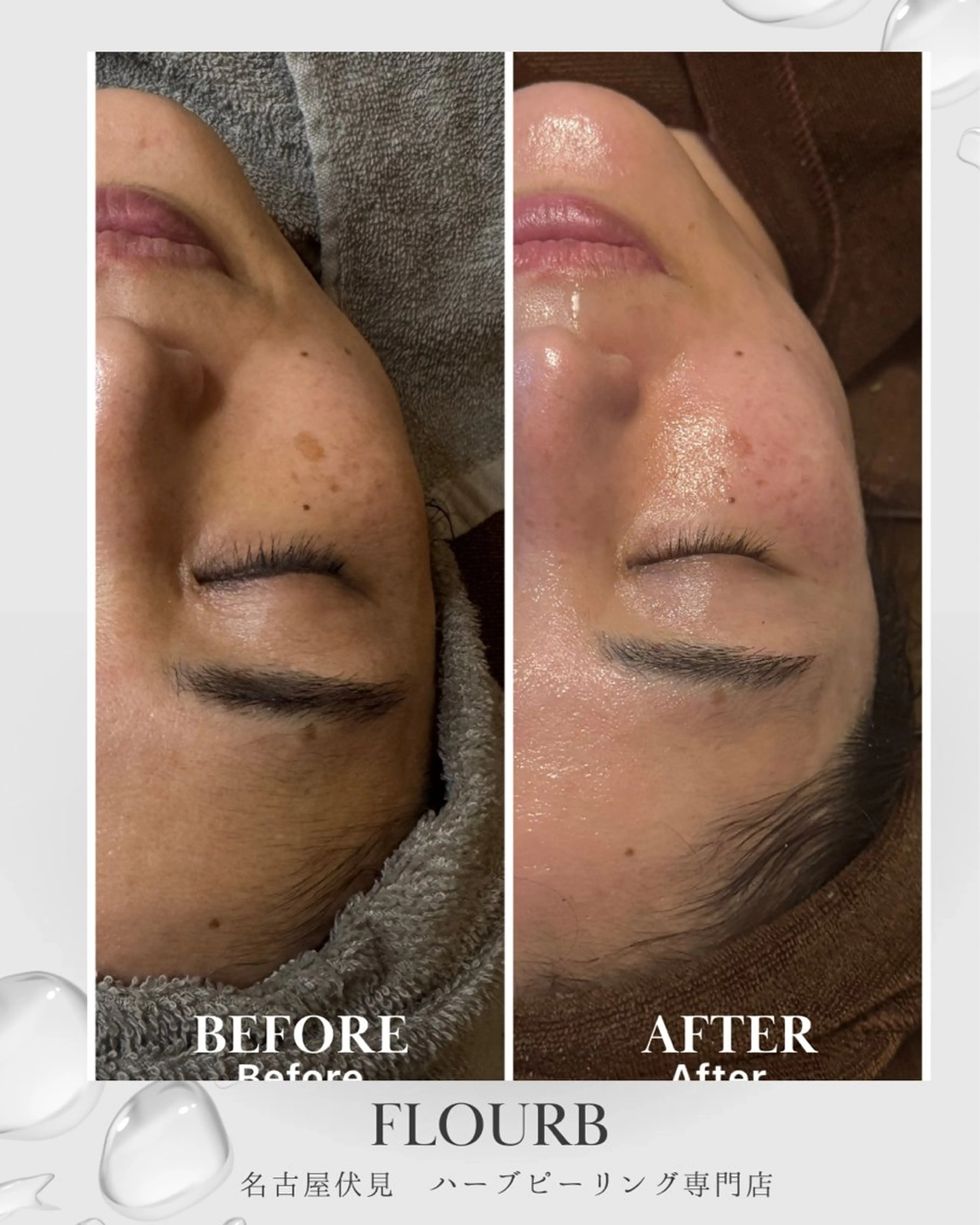 エステ ハーブピーリング専門 サロンFlourbのエステ・リラクイメージ