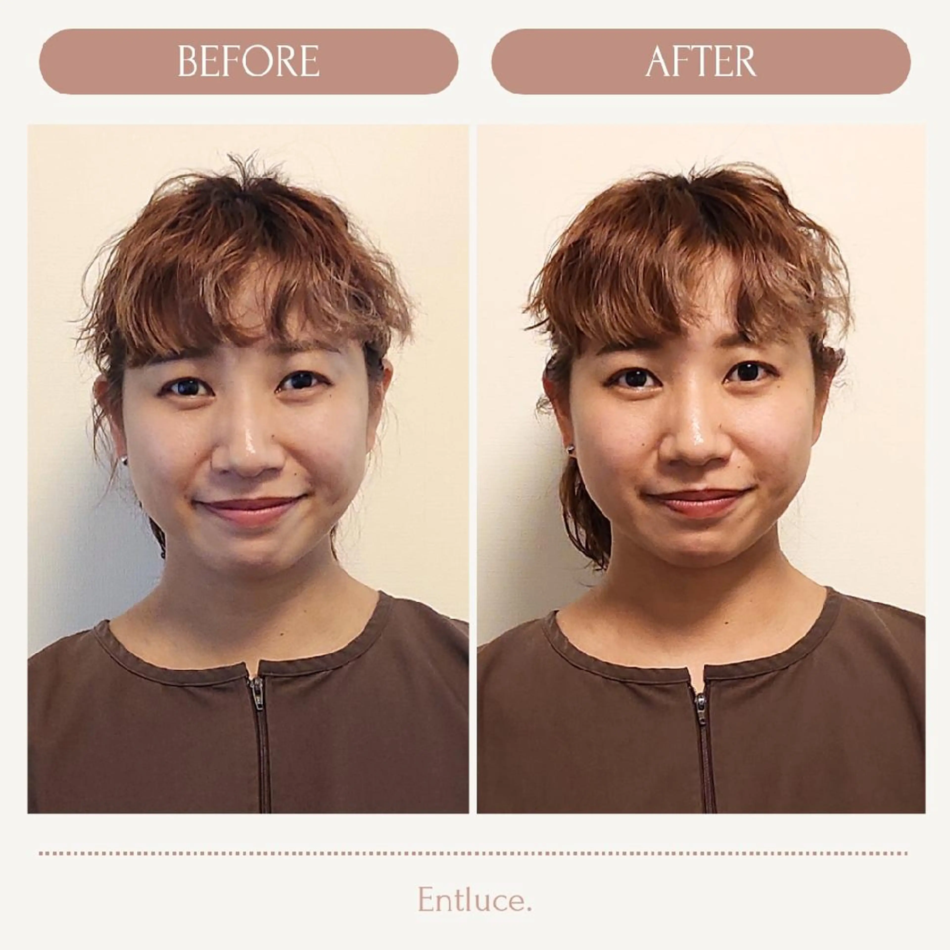 即効⚡小顔美容鍼🪡 むくみたるみ脂肪解消のエステ・リラクイメージ