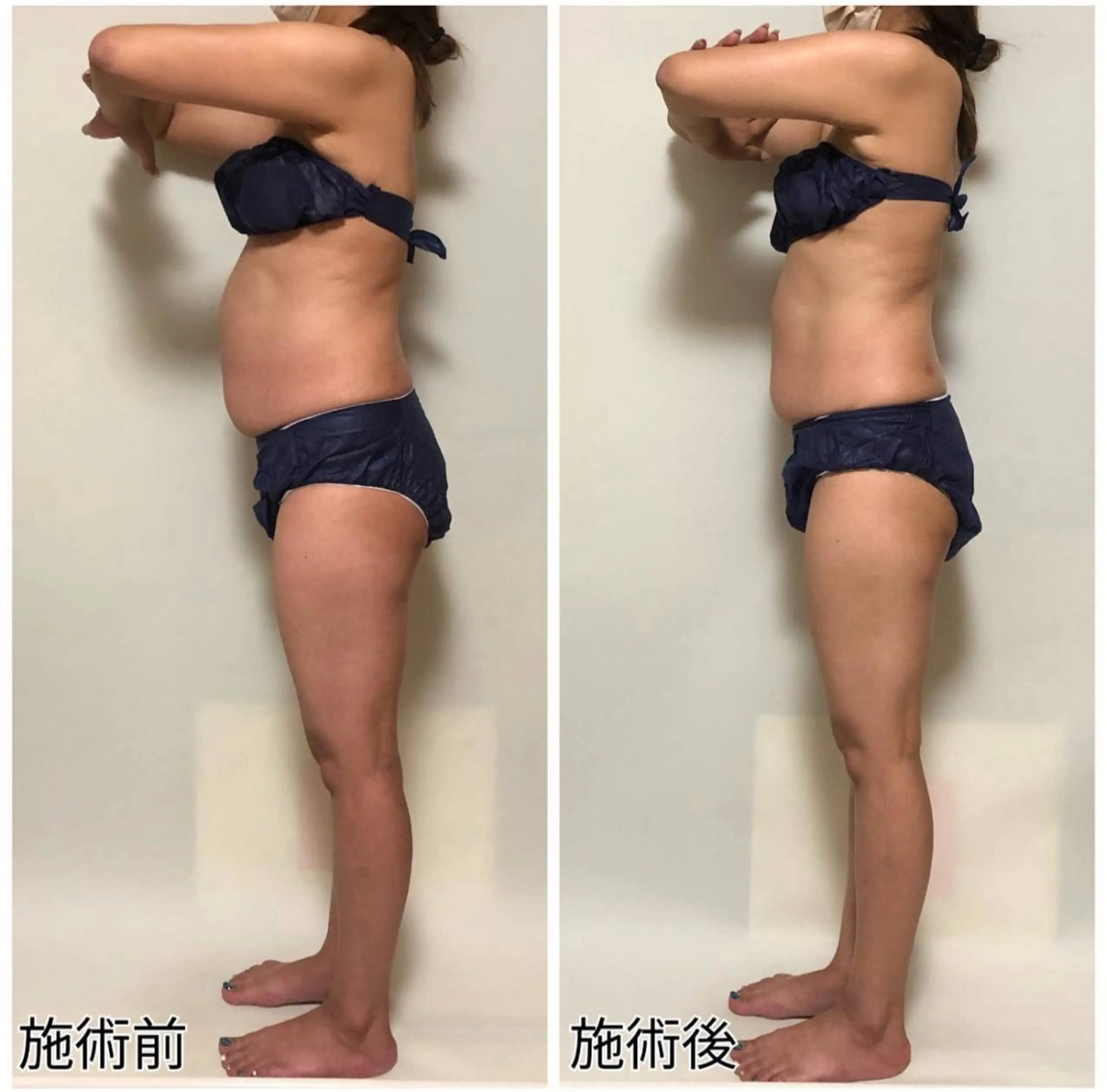 salon lady_goのエステ・リラクイメージ