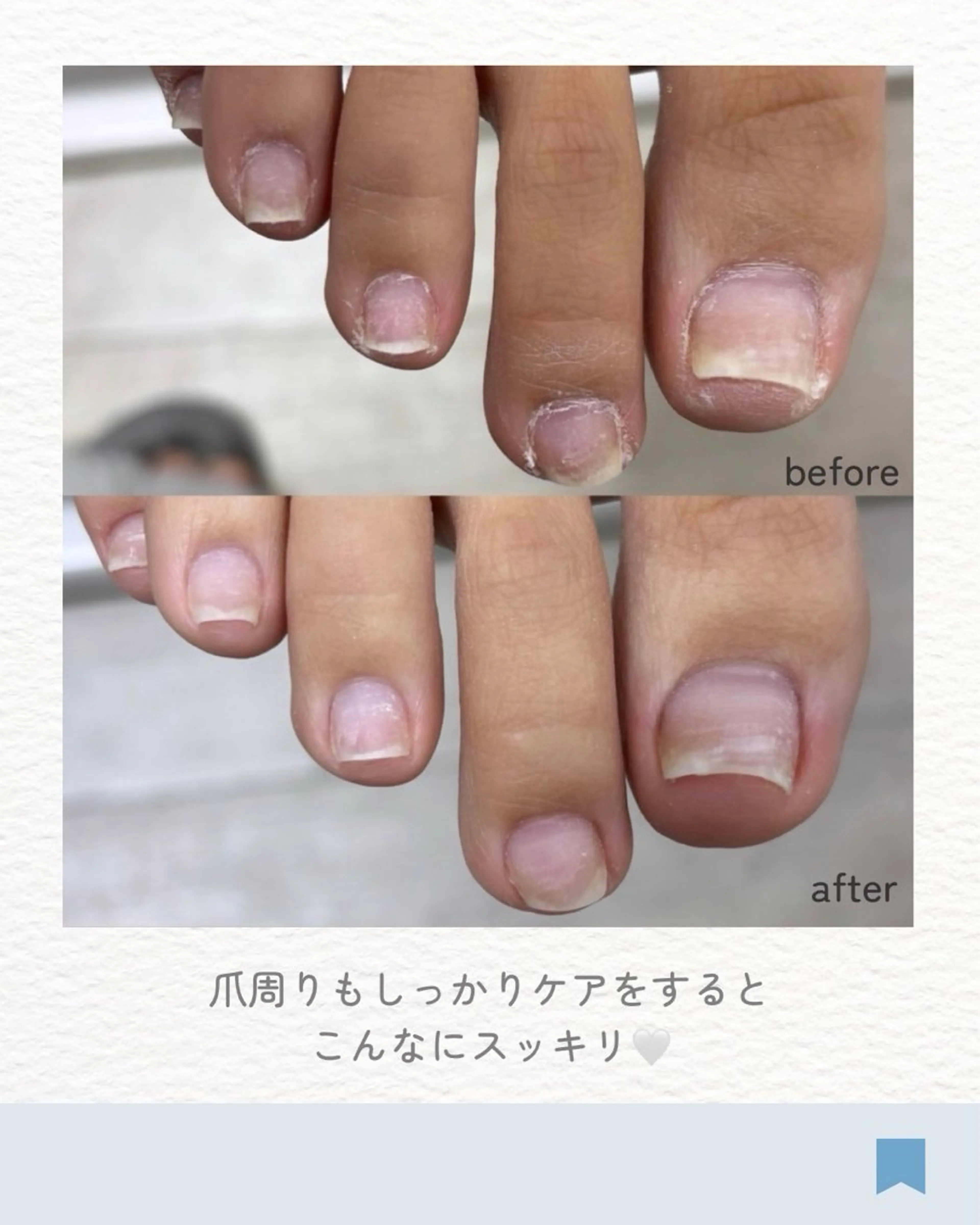 ネイル その他(ネイル) 中川区/ネイル&脱毛 feliceNailのエステ・リラクイメージ