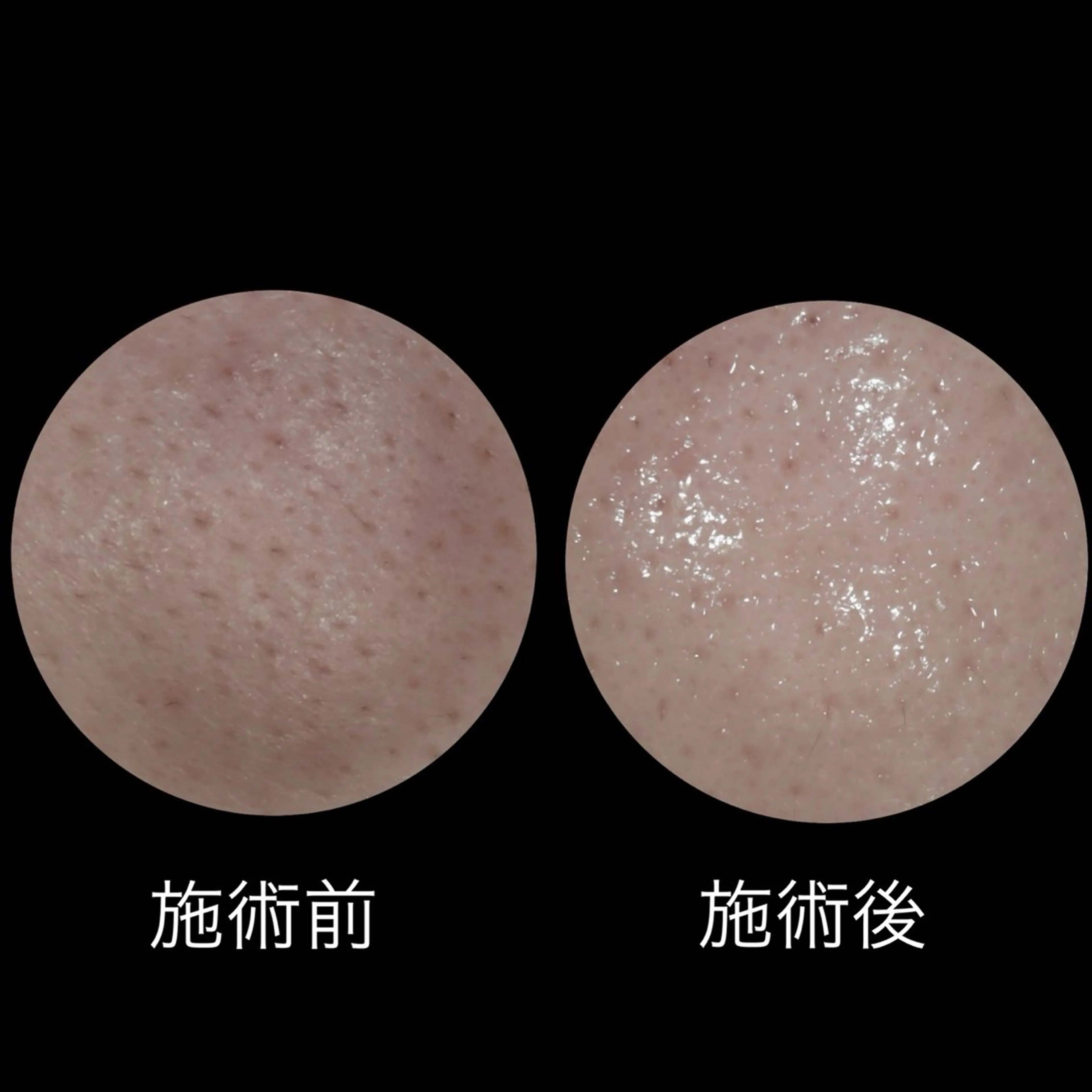 メナード丸の内ヒルズ 柳田りさのエステ・リラクイメージ