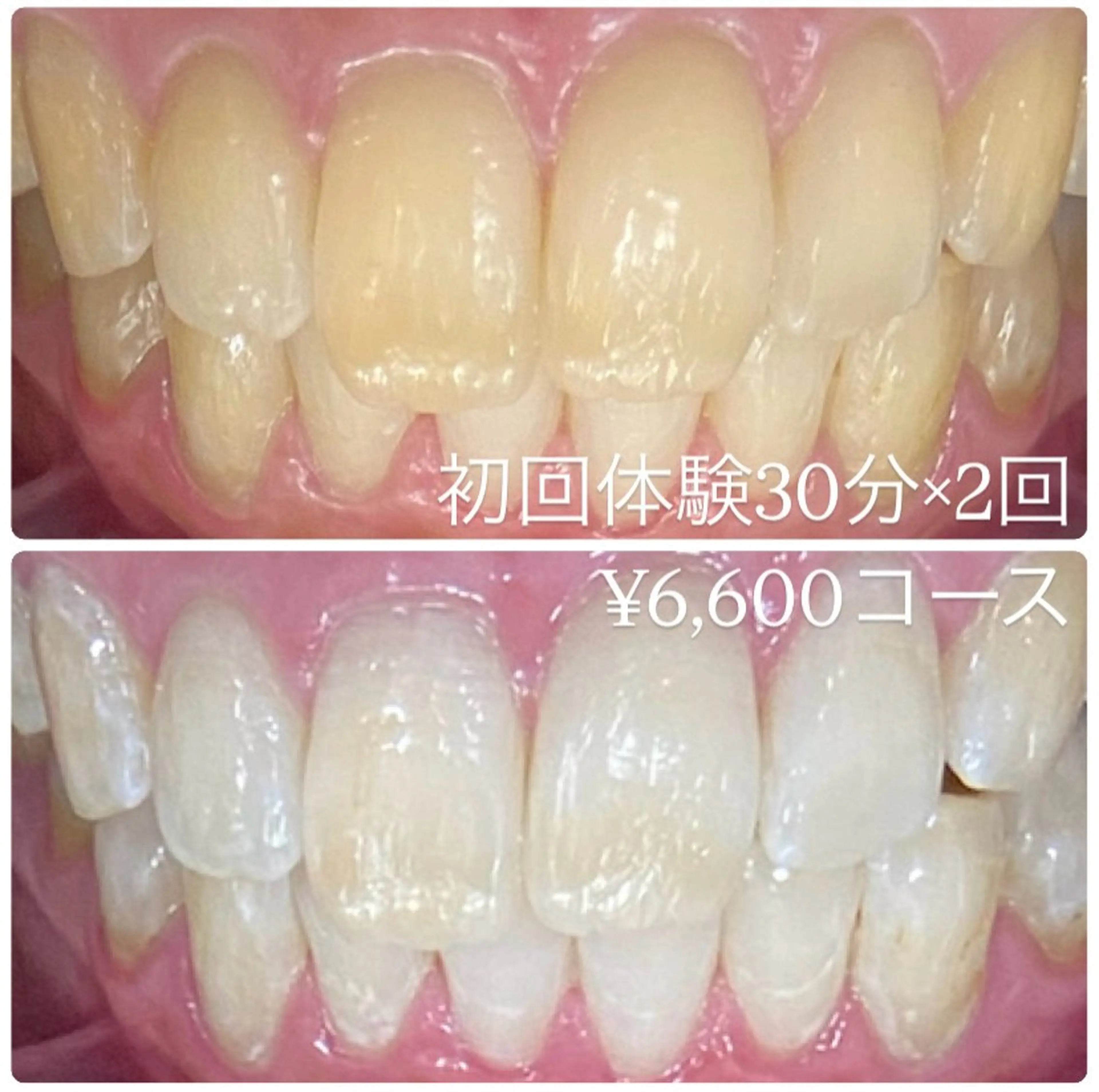 PLATINUM Beauty 横浜店所属・ホワイトニングルーム 横浜店のその他イメージ