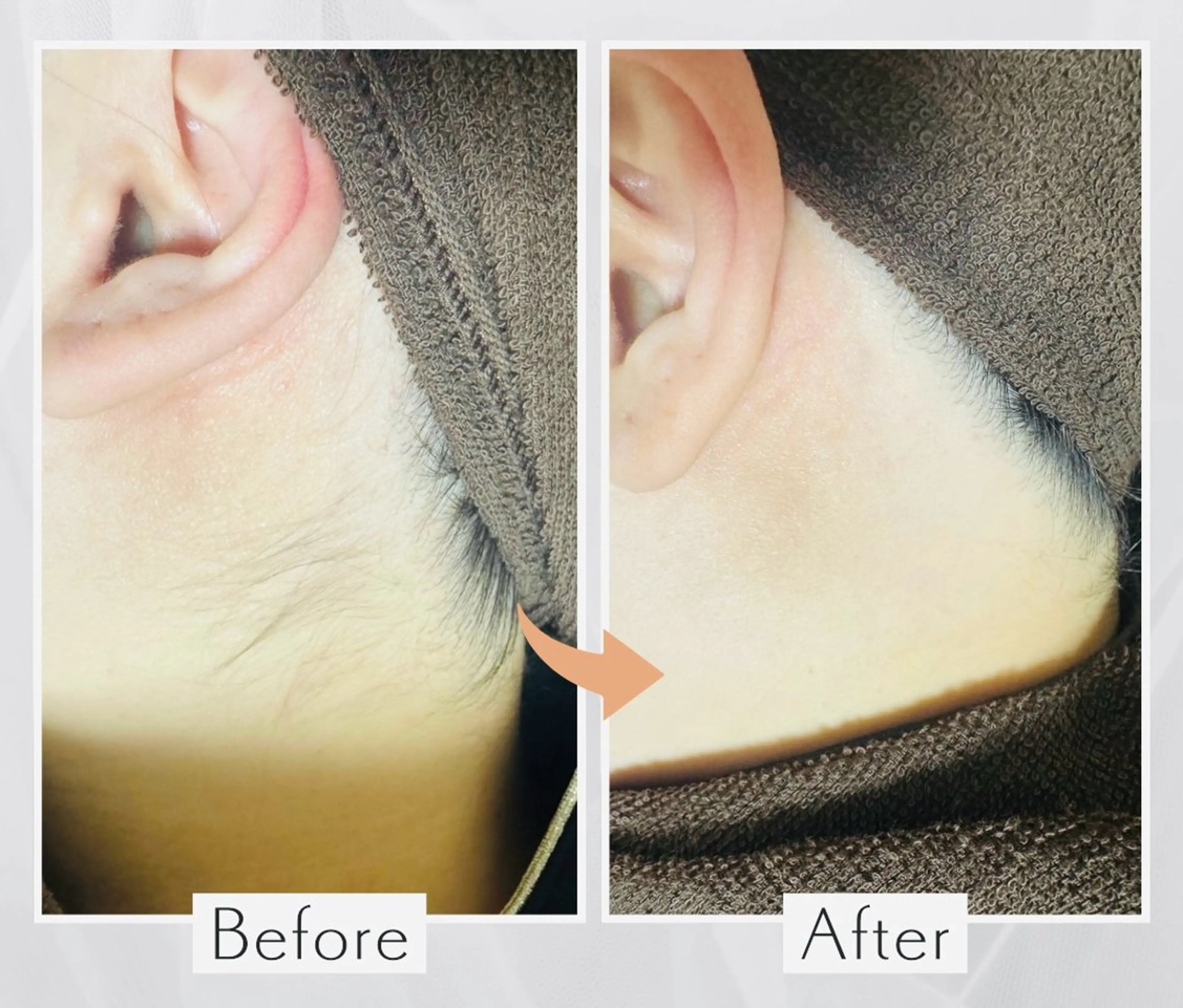 chou. chouのエステ・リラクイメージ