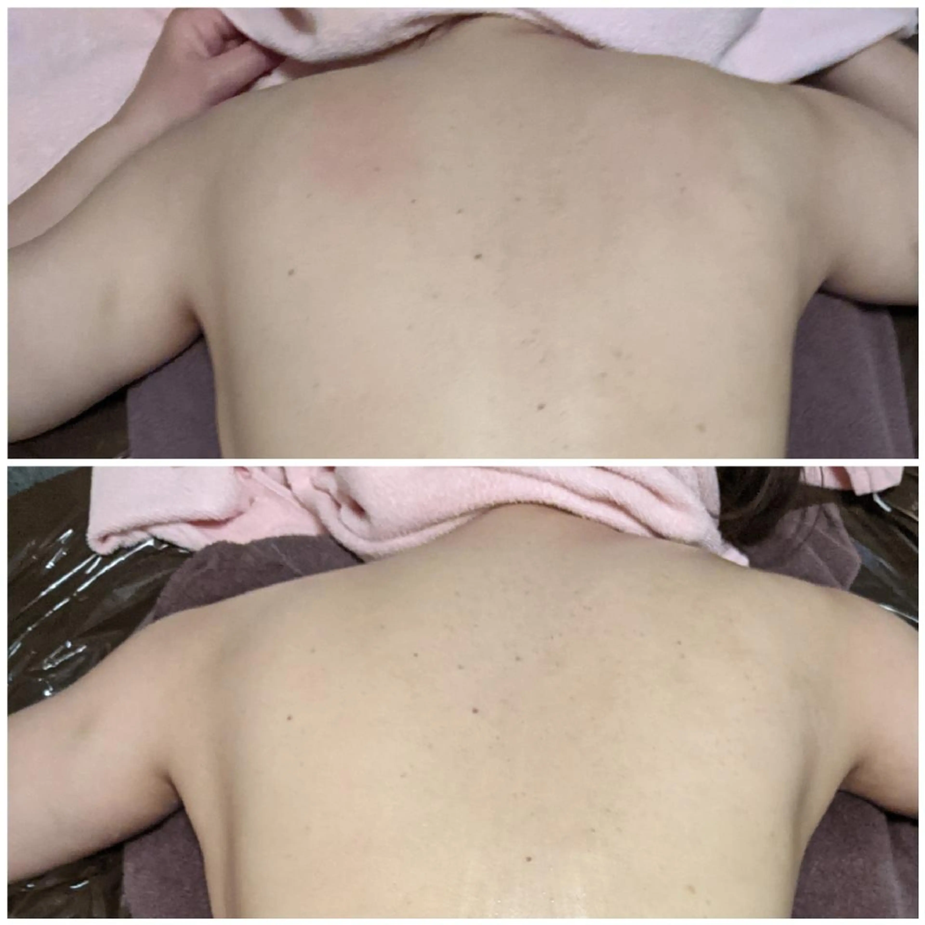 深層リンパオイル/小 顔とドライヘッドスパのエステ・リラクイメージ