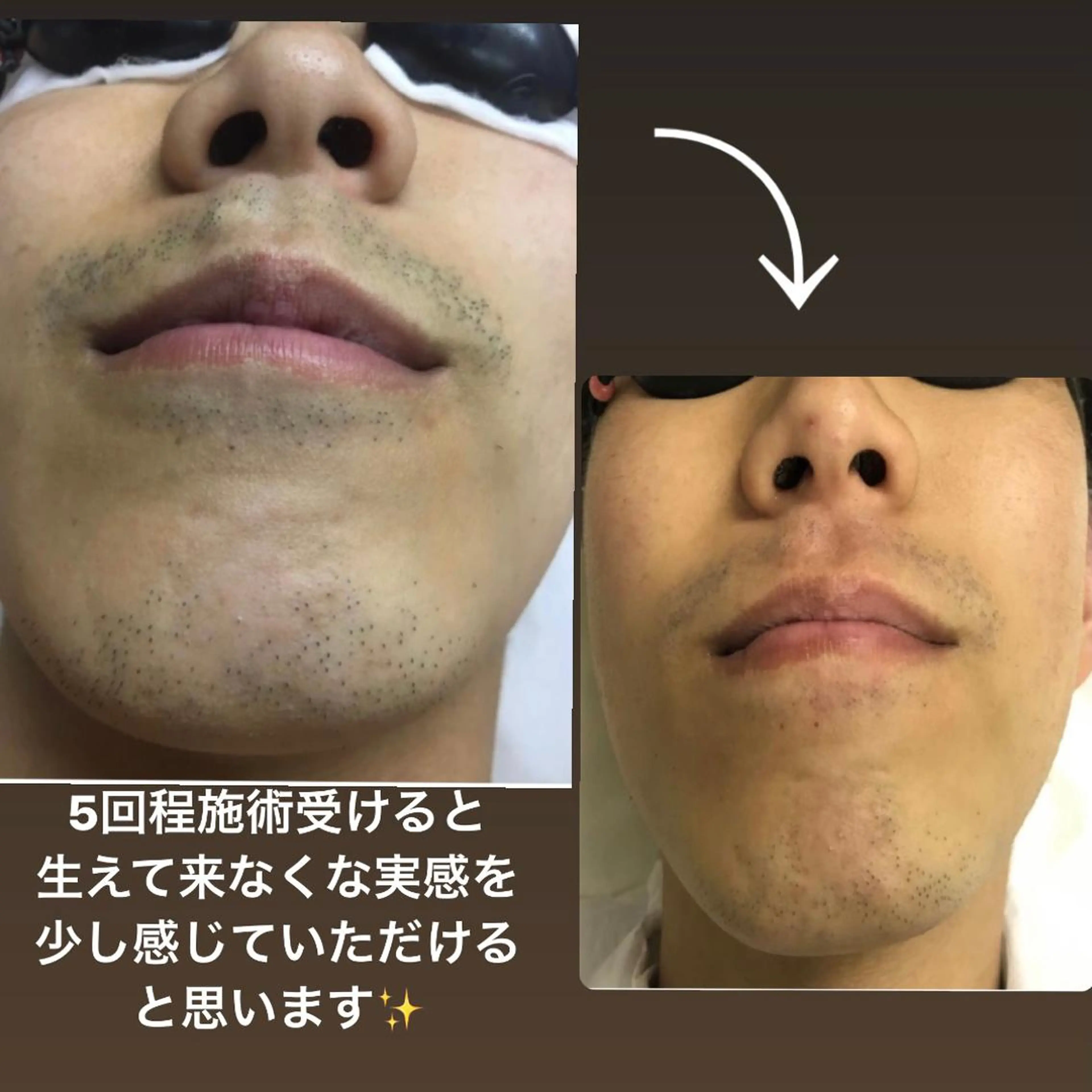 メンズ 脱毛サロン KAvanceのエステ・リラクイメージ