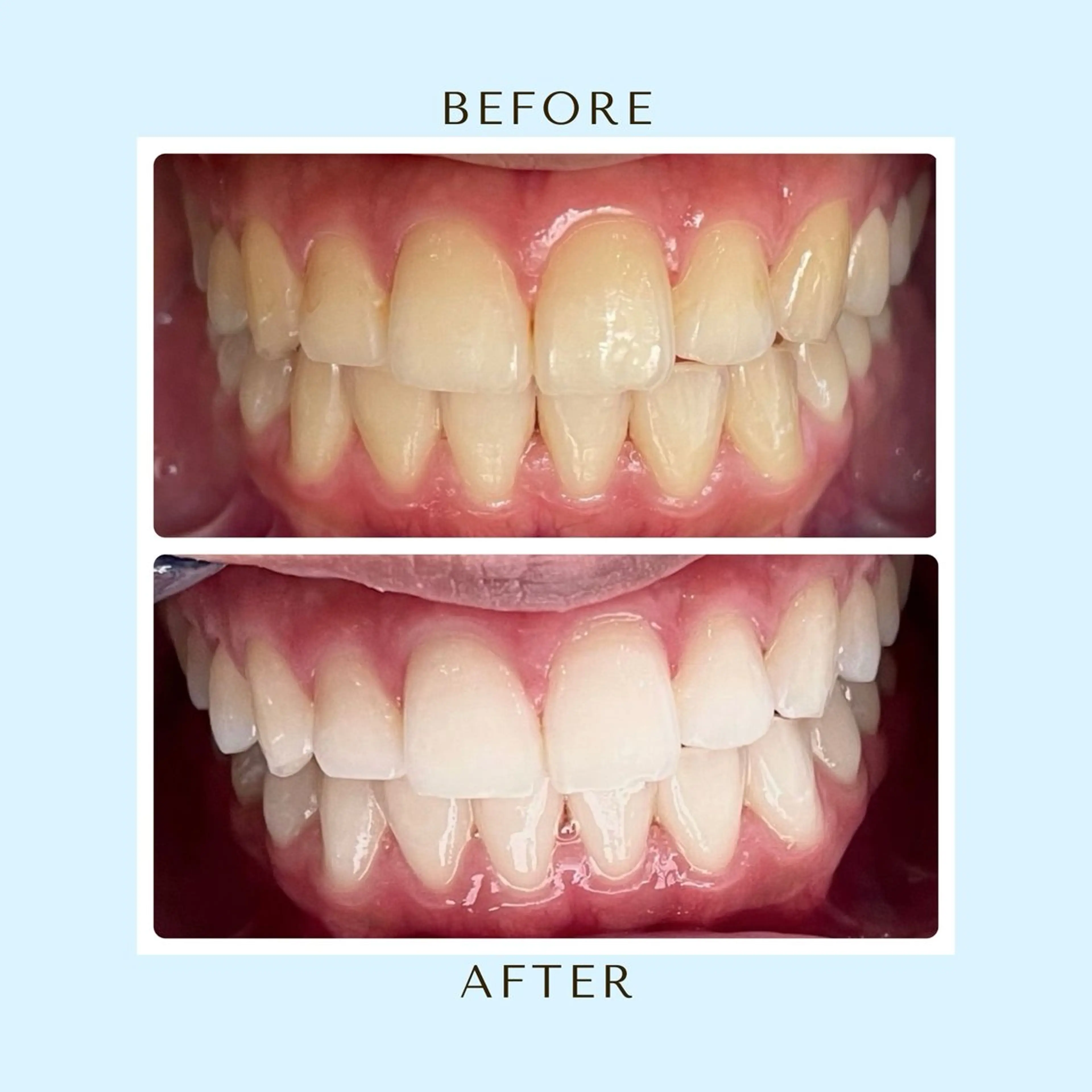 その他 サクッとホワイト 都立大学店のその他イメージ