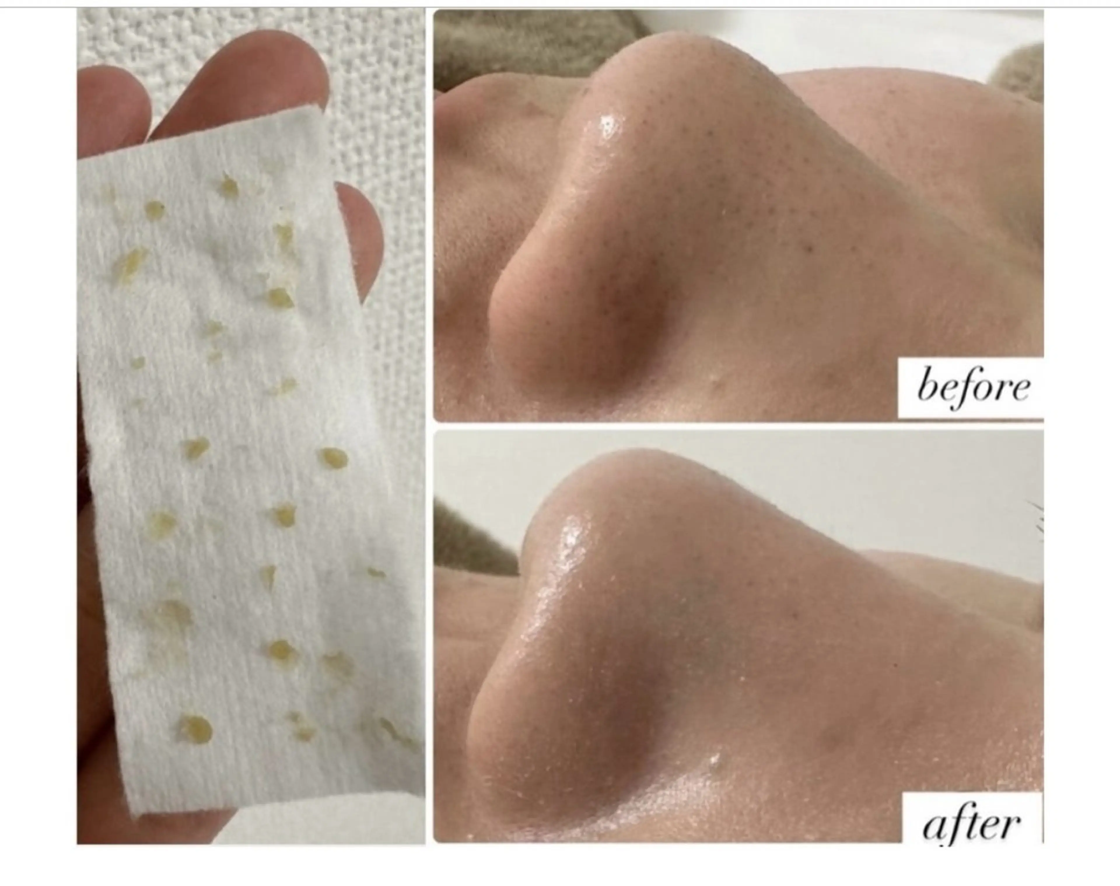 エステ Remy♡ 石井澪菜のエステ・リラクイメージ