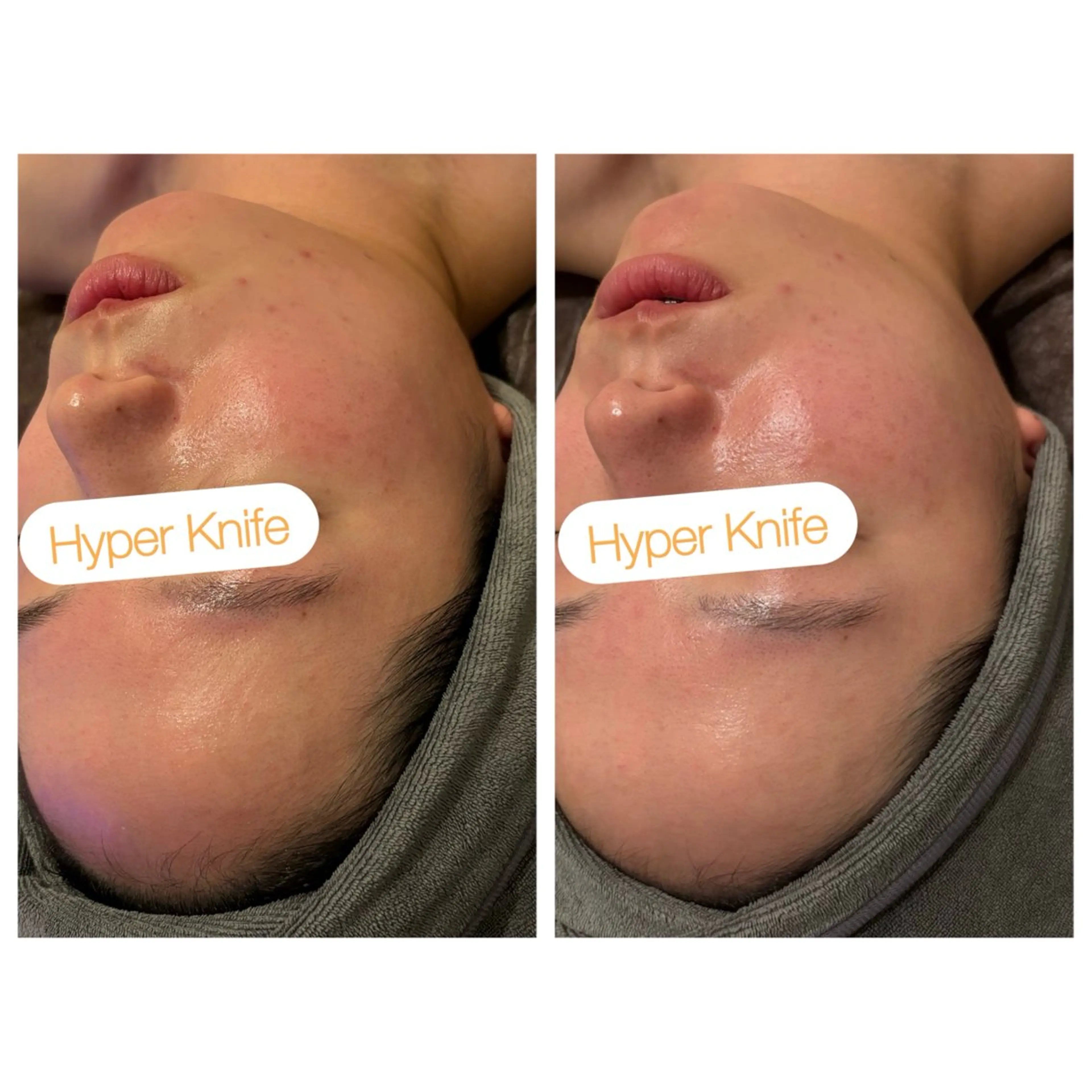 エステ リラク 小顔コルギ ☆表参道/外苑前のエステ・リラクイメージ