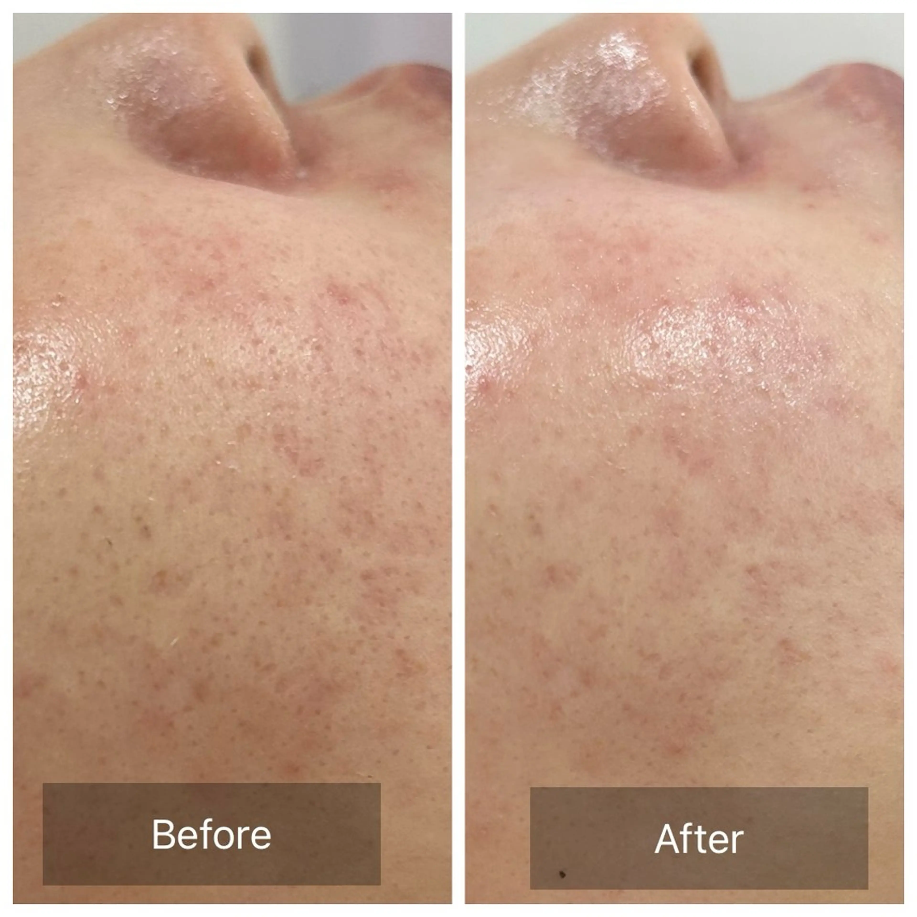 エステ 【現役看護師】高来 笑子のエステ・リラクイメージ