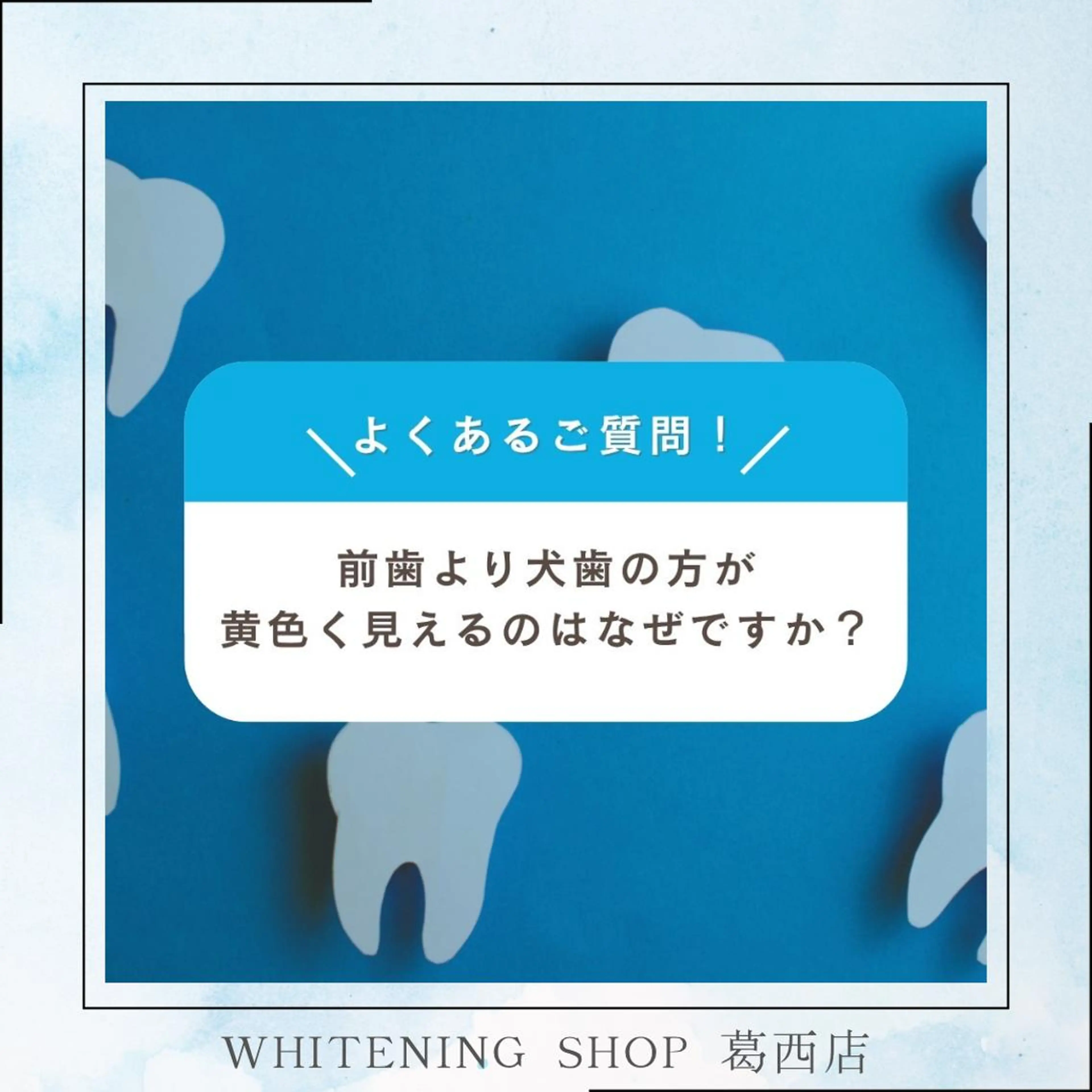 メンズ その他 ホワイトニング ショップ葛西店のその他イメージ