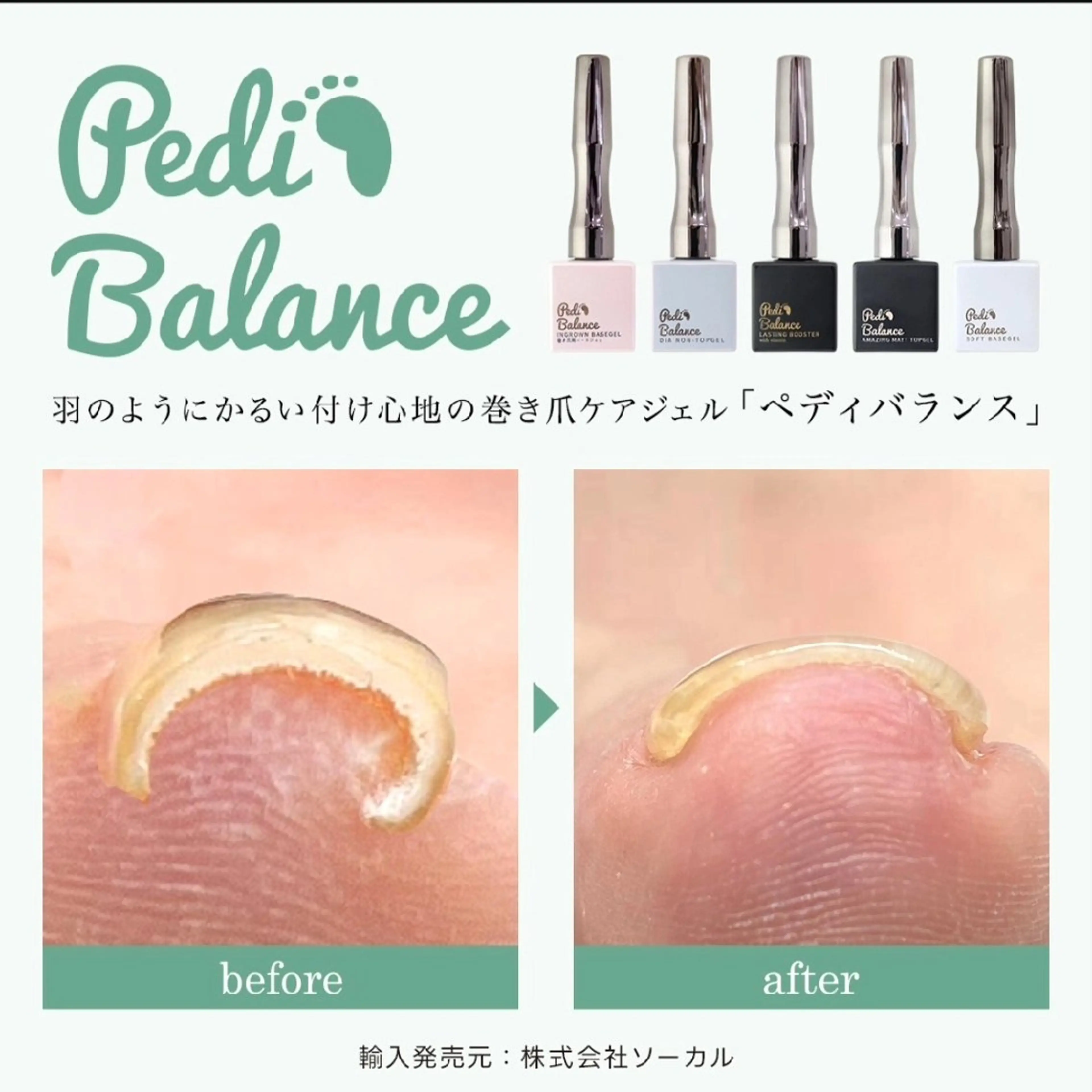 ネイル Micky nail chikushinoのその他イメージ