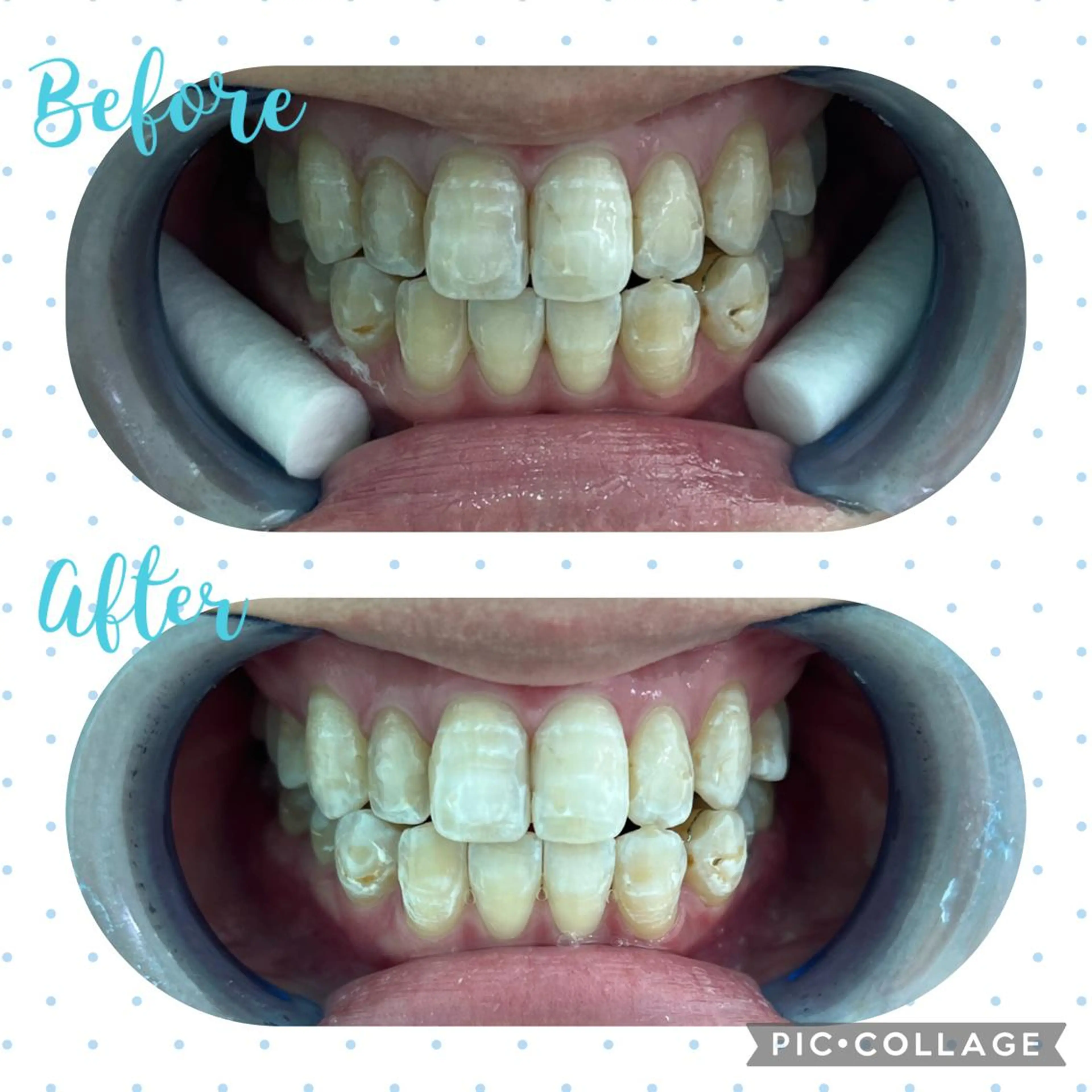 その他 セルフホワイトニング COCOSHIROのエステ・リラクイメージ