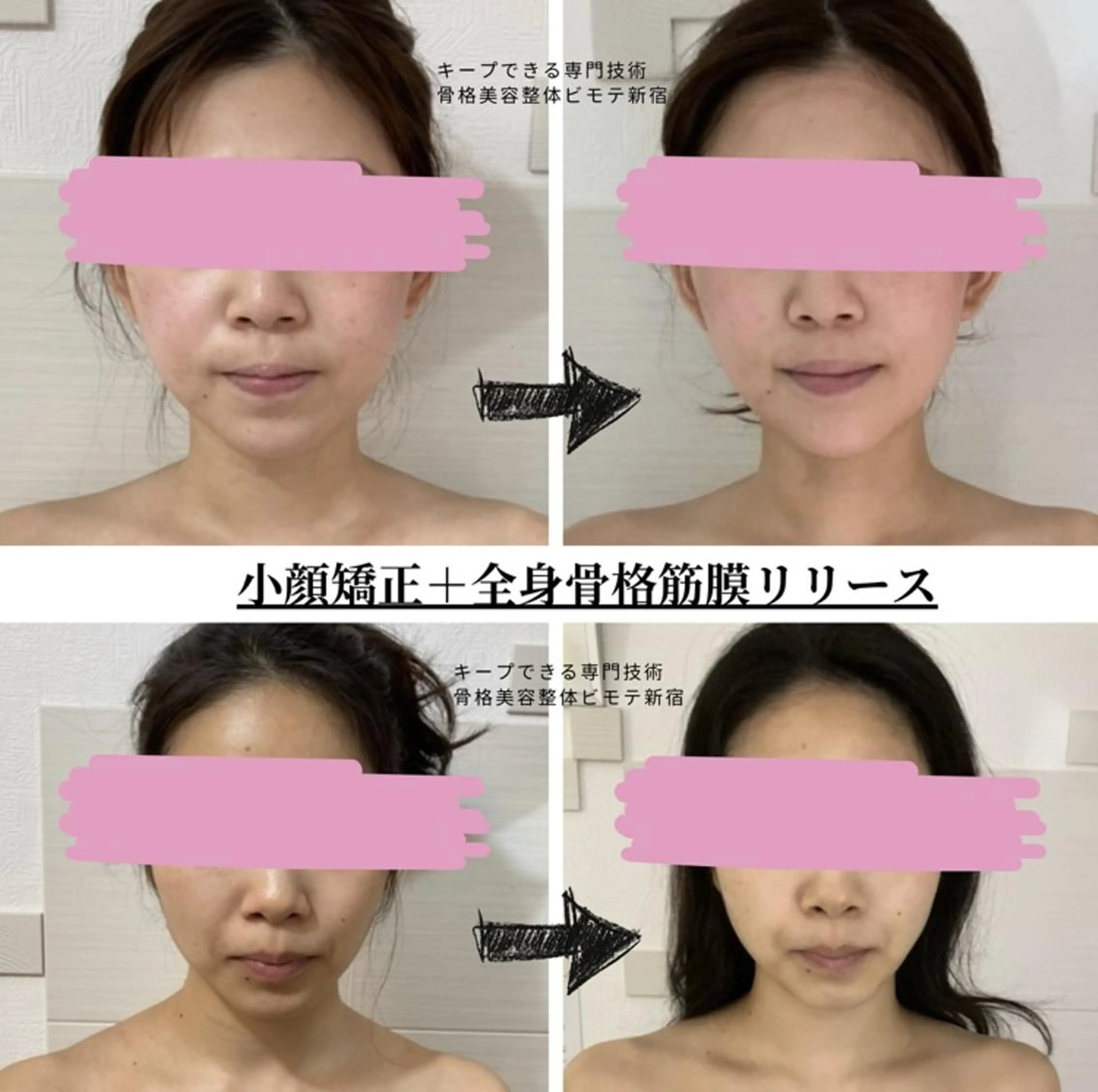 女性限定🍀【全身骨格筋膜リリース+小顔矯正】ボディトリートメント✨美顔/フェイシャルエステ/肩こり/脚瘦せ/バストケアの写真