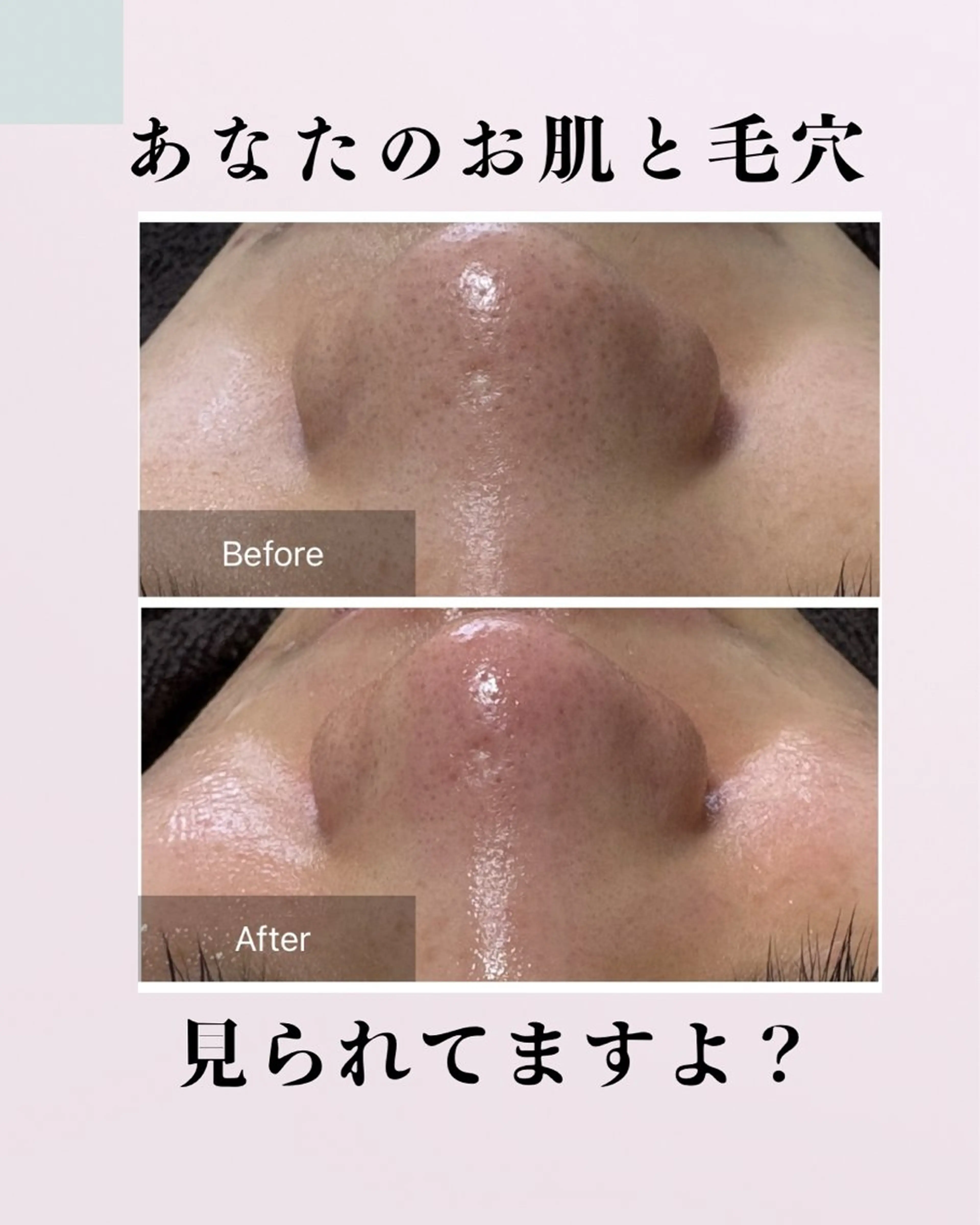 肌質改善サロン facialmoonのエステ・リラクイメージ