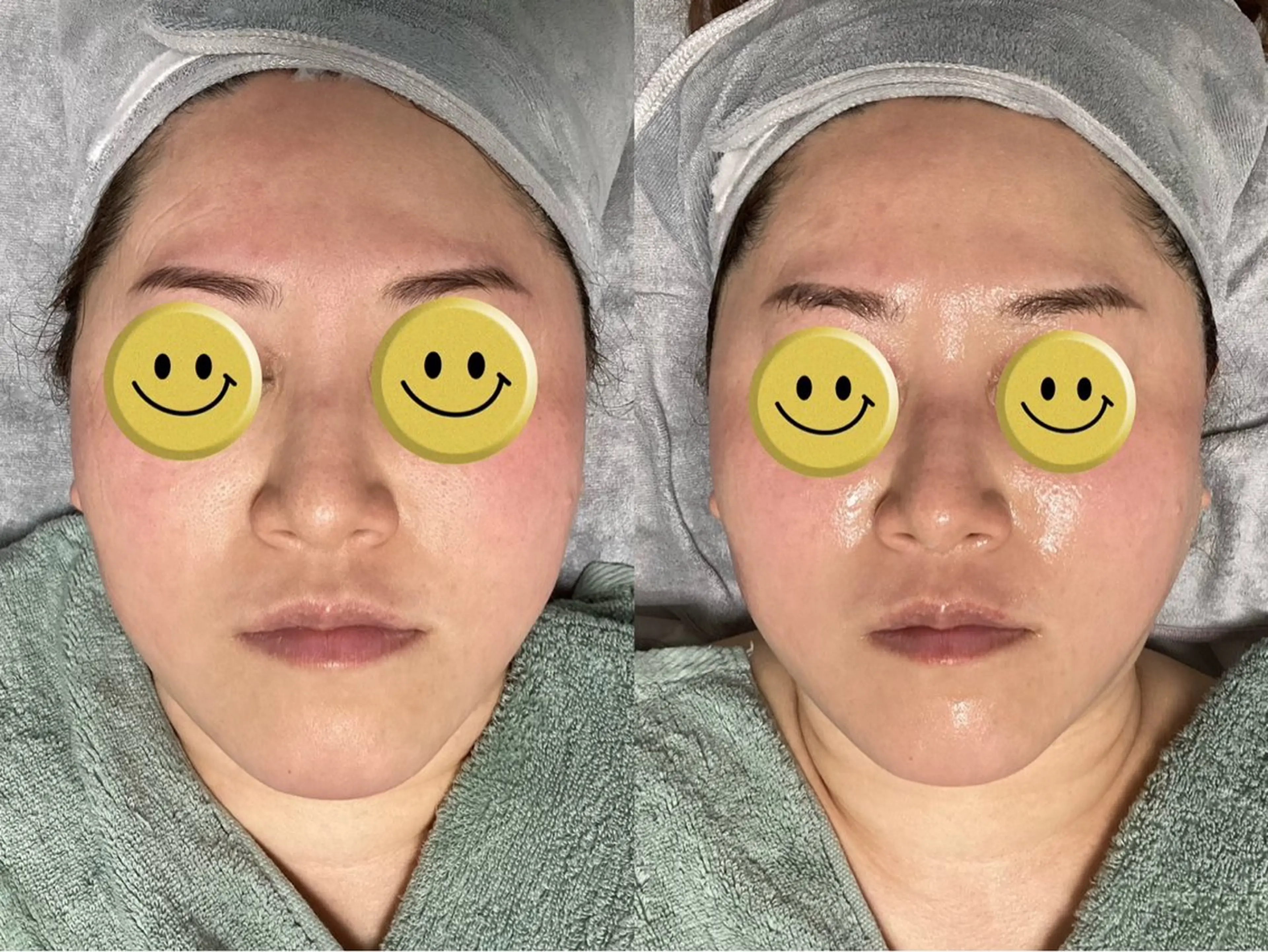 【ぷるぷる水光マイグロ二ドル】の写真