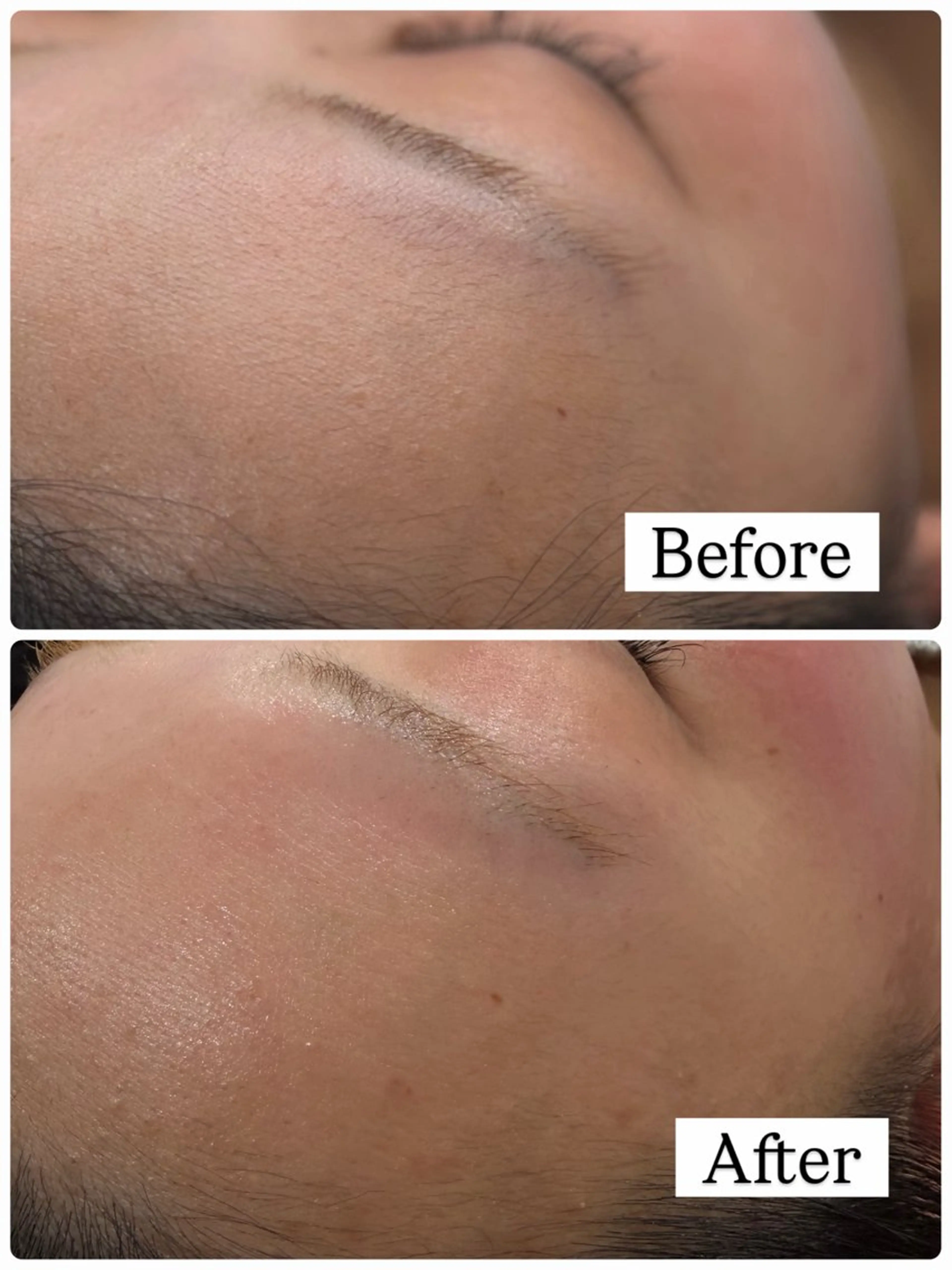 脱毛 MIRUS所属・脱毛サロンMIRUS Yuukaのエステ・リラクイメージ