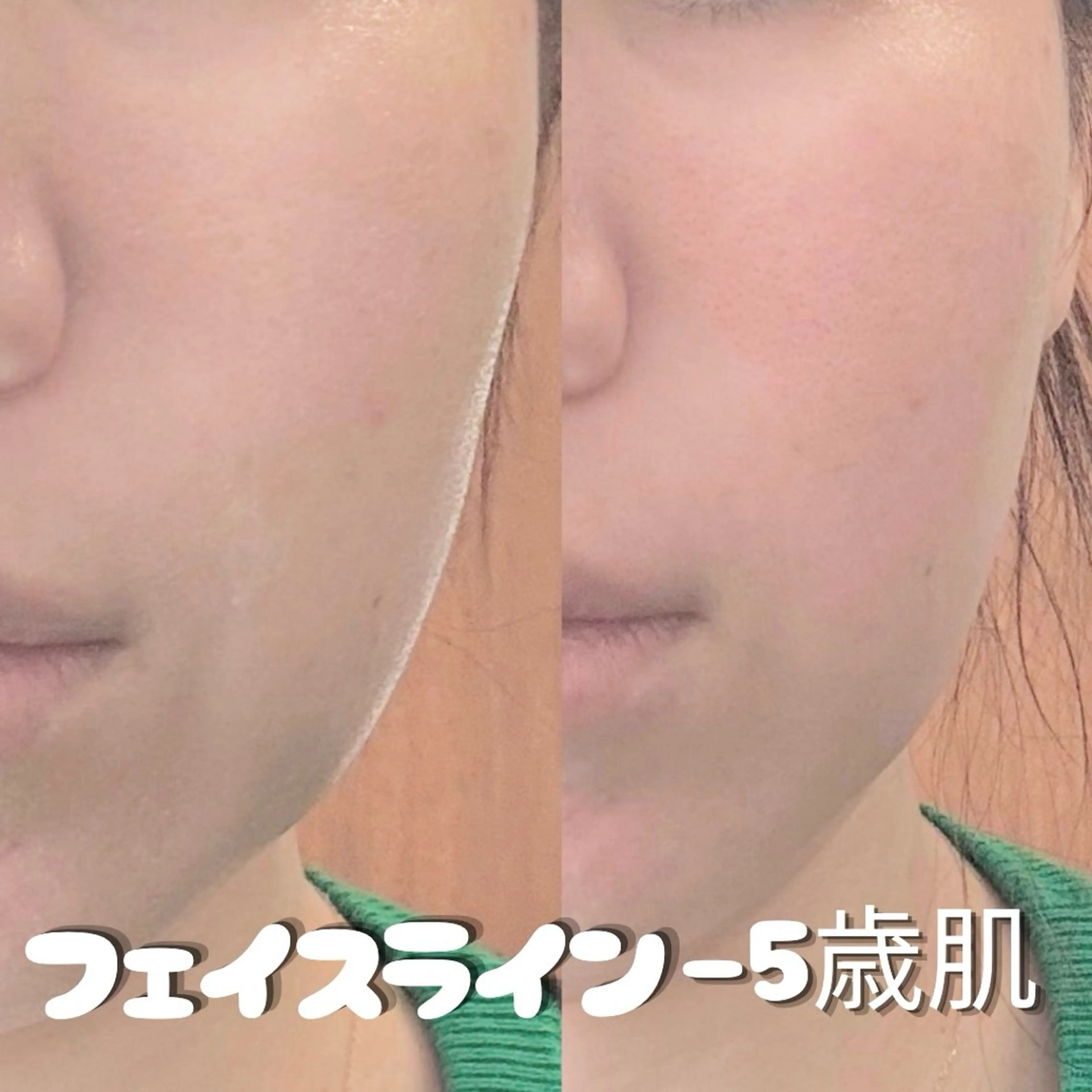エステ Balance facialのエステ・リラクイメージ