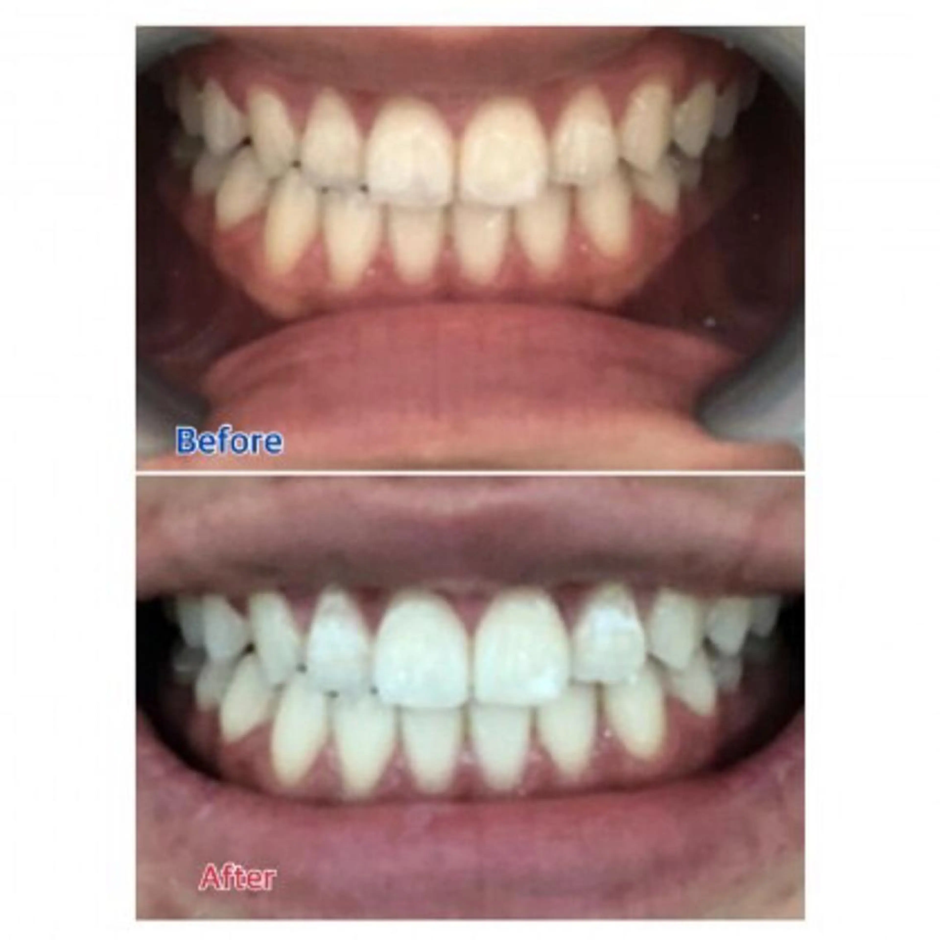 Ｍ渋谷 ホワイトニングのエステ・リラクイメージ