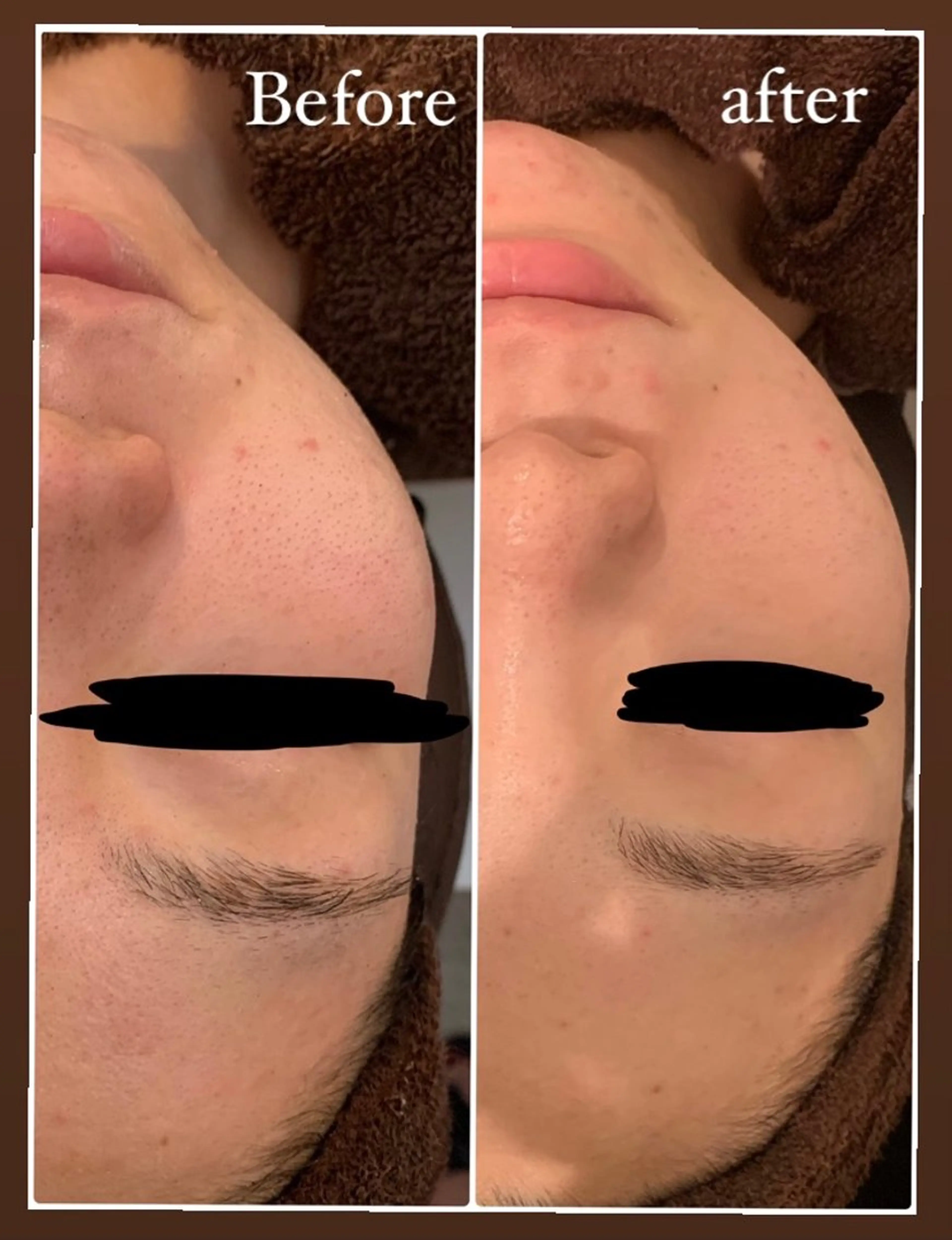 本気の肌質改善スキン デトックス🌿のエステ・リラクイメージ