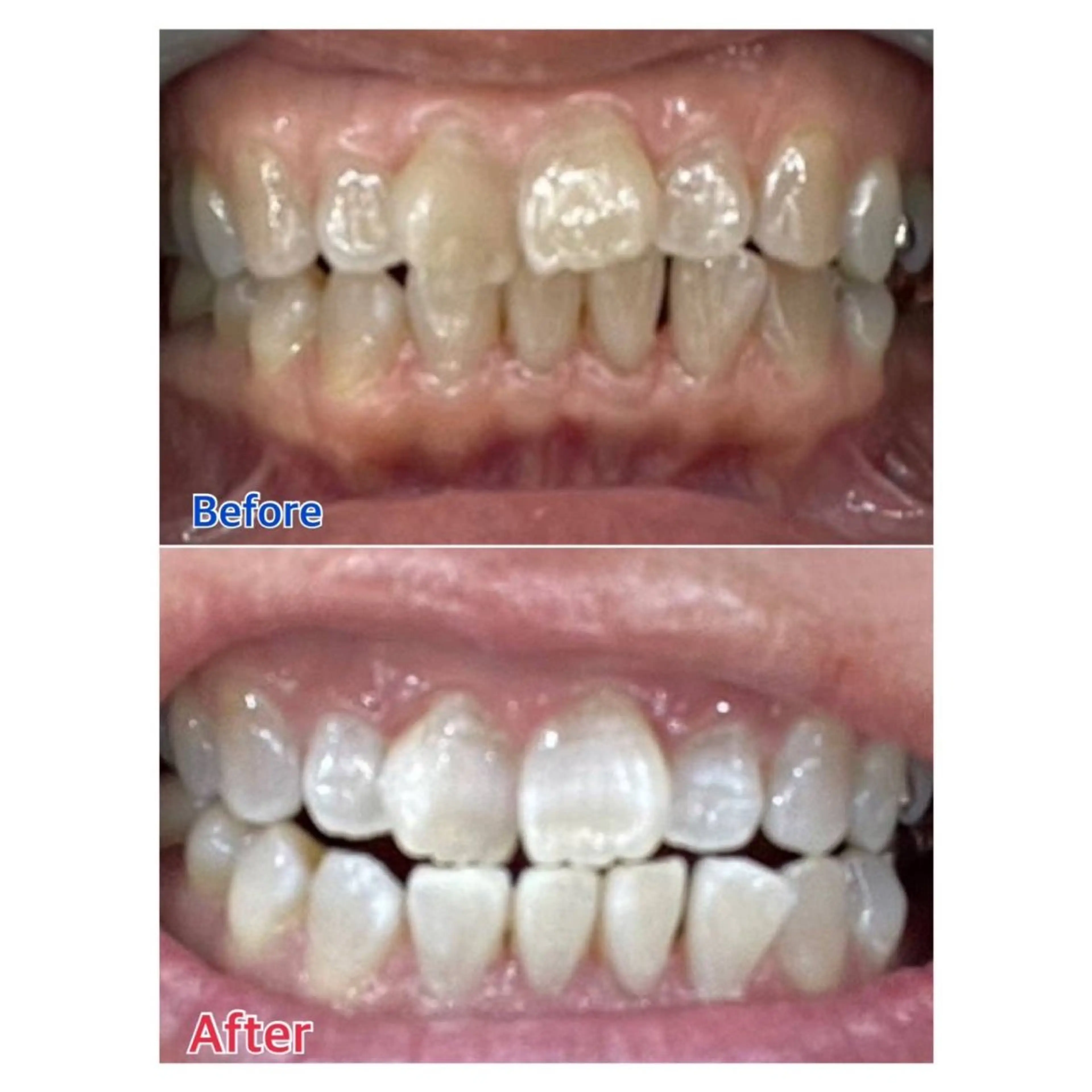 MBEAUTYSALON 千葉店・京成大久保所属・Melty 輝のその他イメージ